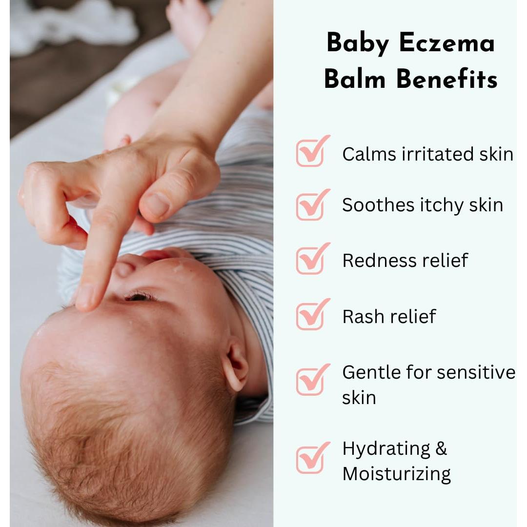 Bálsamo para Eczema Bebé - Crema Hidratante 226g