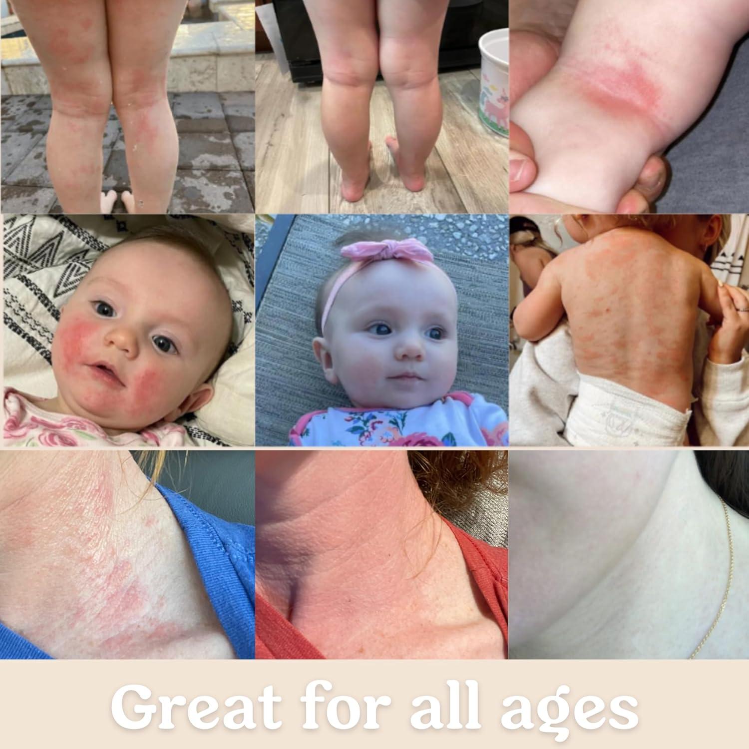 Crema Barrera para Bebés Roe Wellness 230g Hidratante Piel Seca