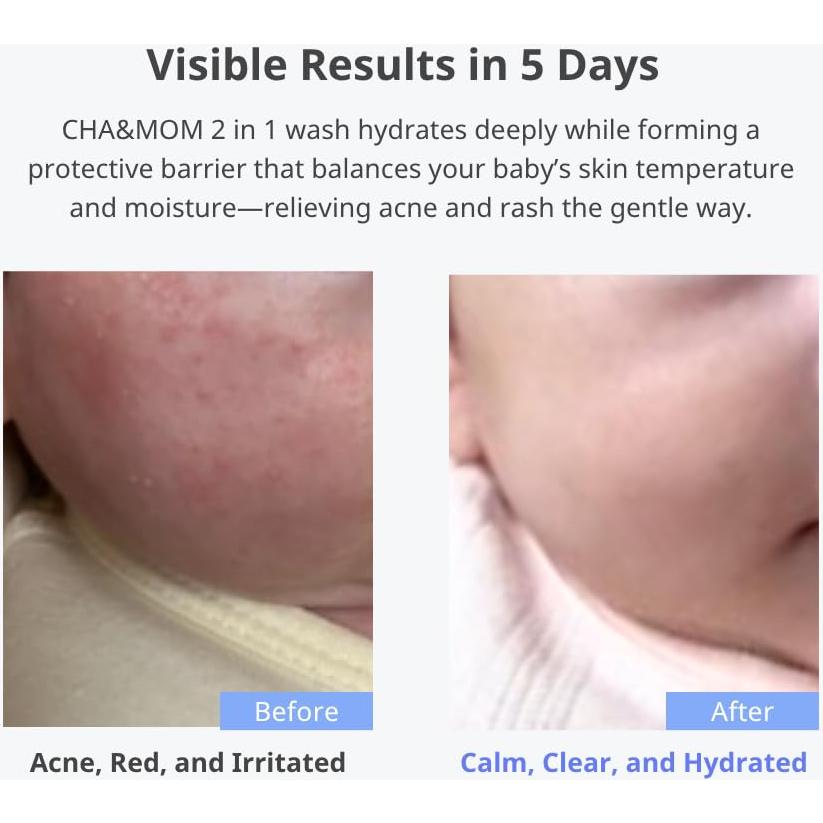 Jabón para Bebés Cha&Mom 300ml - Hipoalergénico y Natural