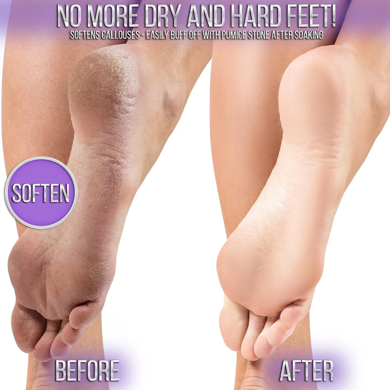 Paquete de Pedicura SOO JELLY - Remojo de Gel Hidratante Lavanda