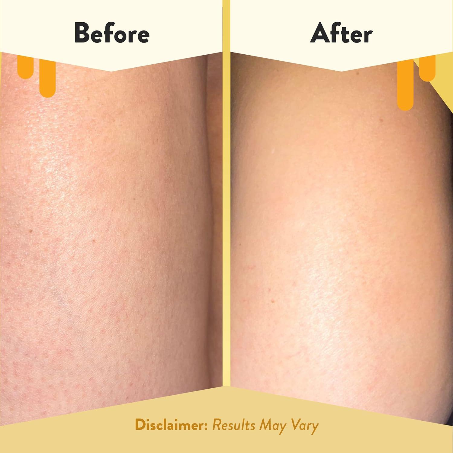 Jabón Corporal Eczema Honey 368.5 g - Gel de Ducha Calmante