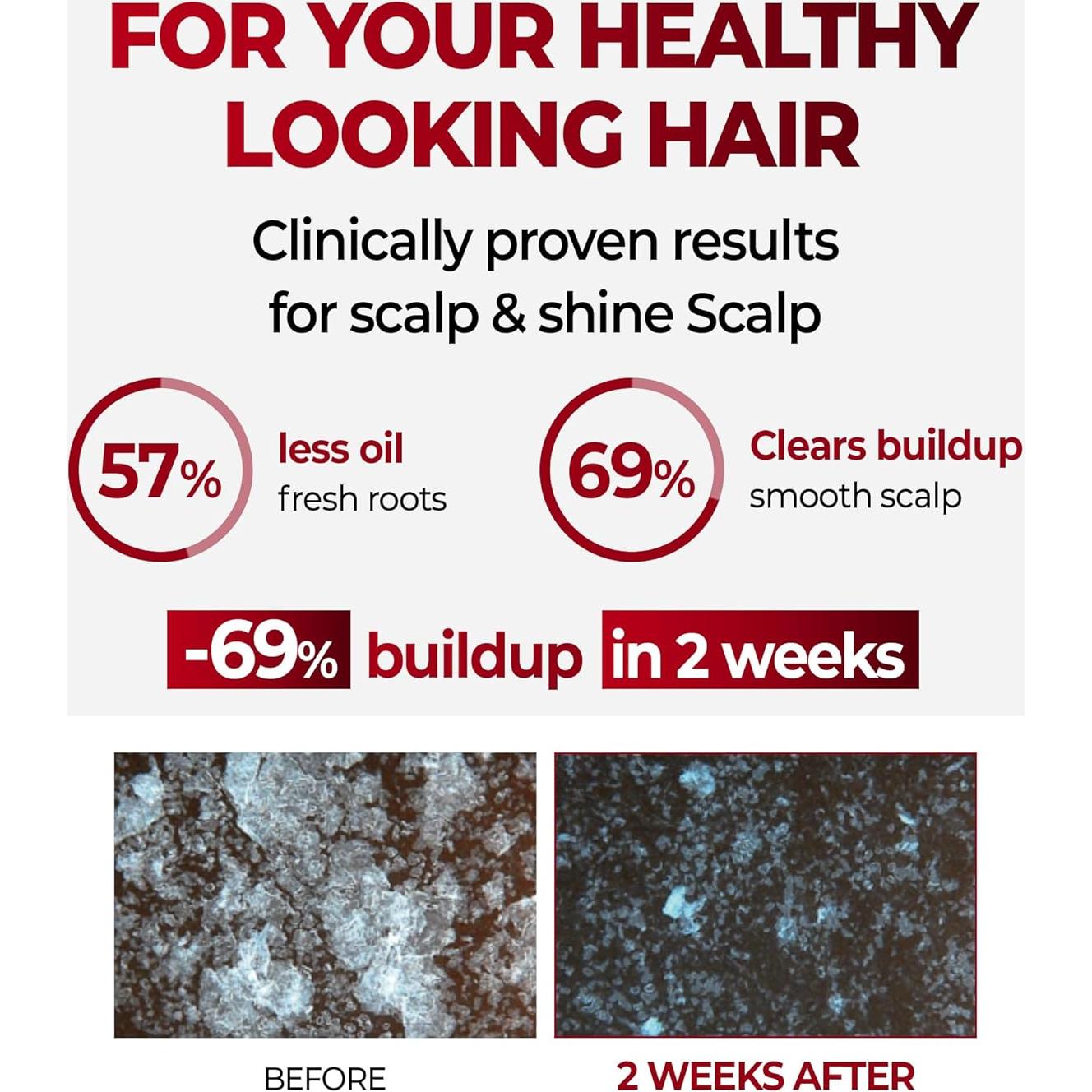 Champú KUNDAL para Cuero Cabelludo con Cafeína 500 ml