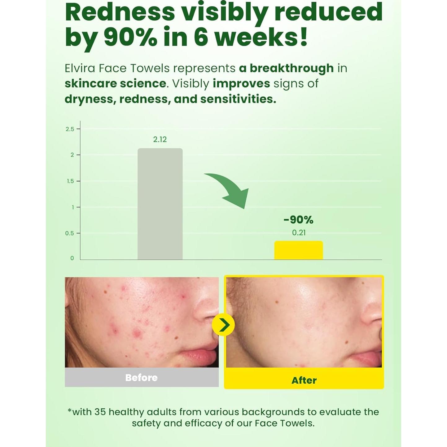 Elvira 100 Count Disposable Face Towels, Biodegradable Facial Cleansing Towels, Ultra Soft & Thick Cloth for Sensitive Skin, Makeup Remover Dry Wipes, Lint-Free Towelettes for Cleansing