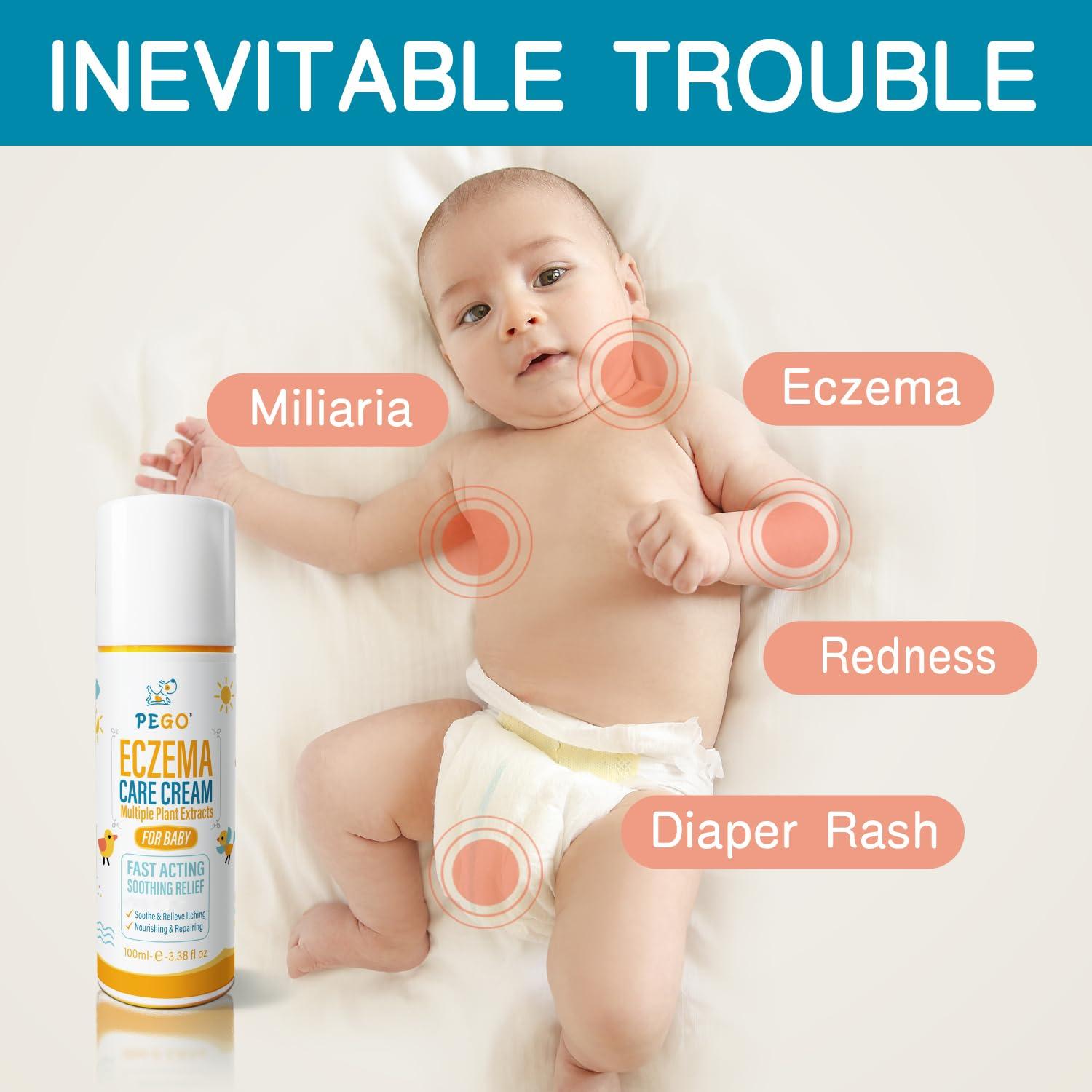 Crema para Eccema Infantil AOAO 100ml - Hipoalergénica y Nutritiva