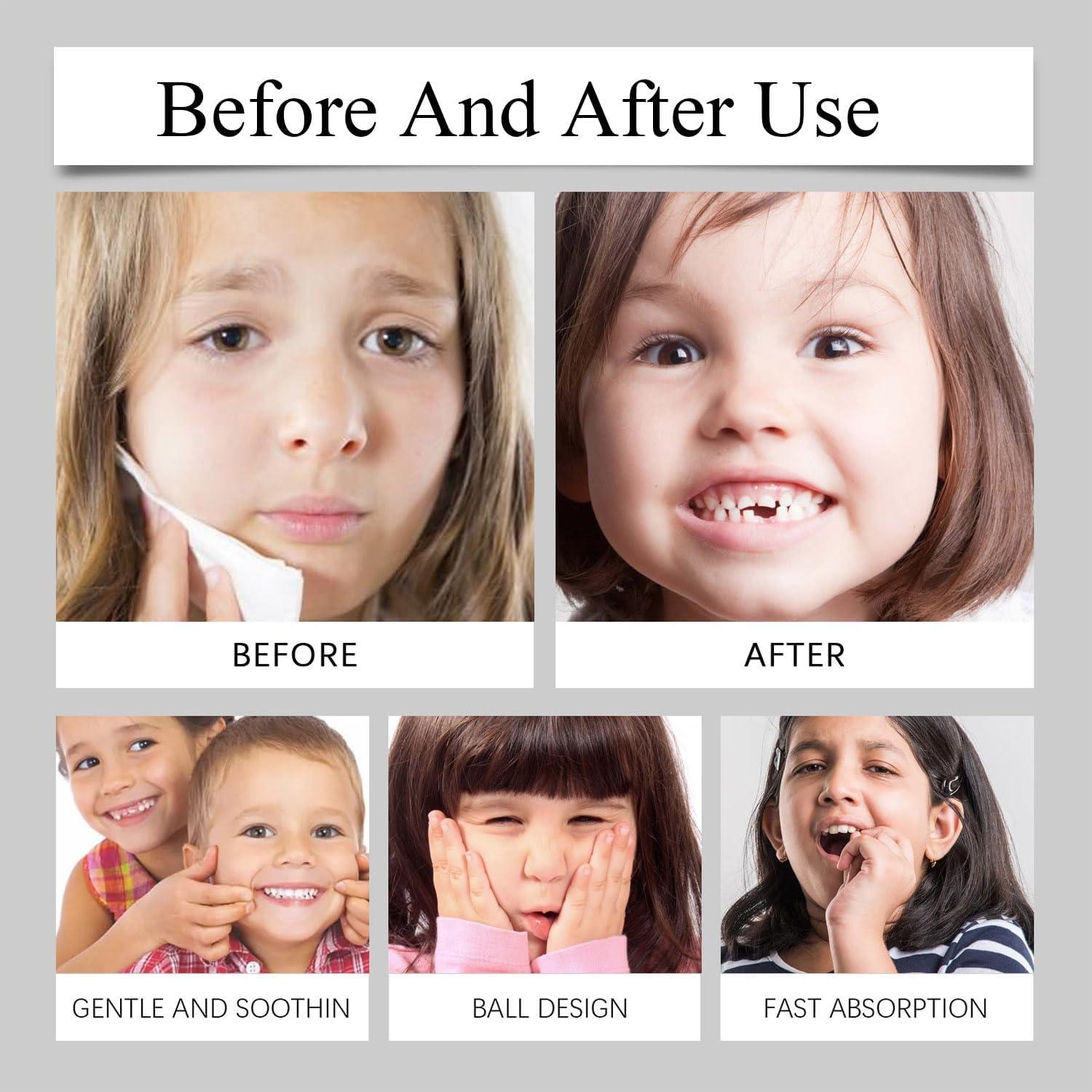 Rodillo de Dentición Natural 3PCS BIJIELAODIAO Alivio Bebés