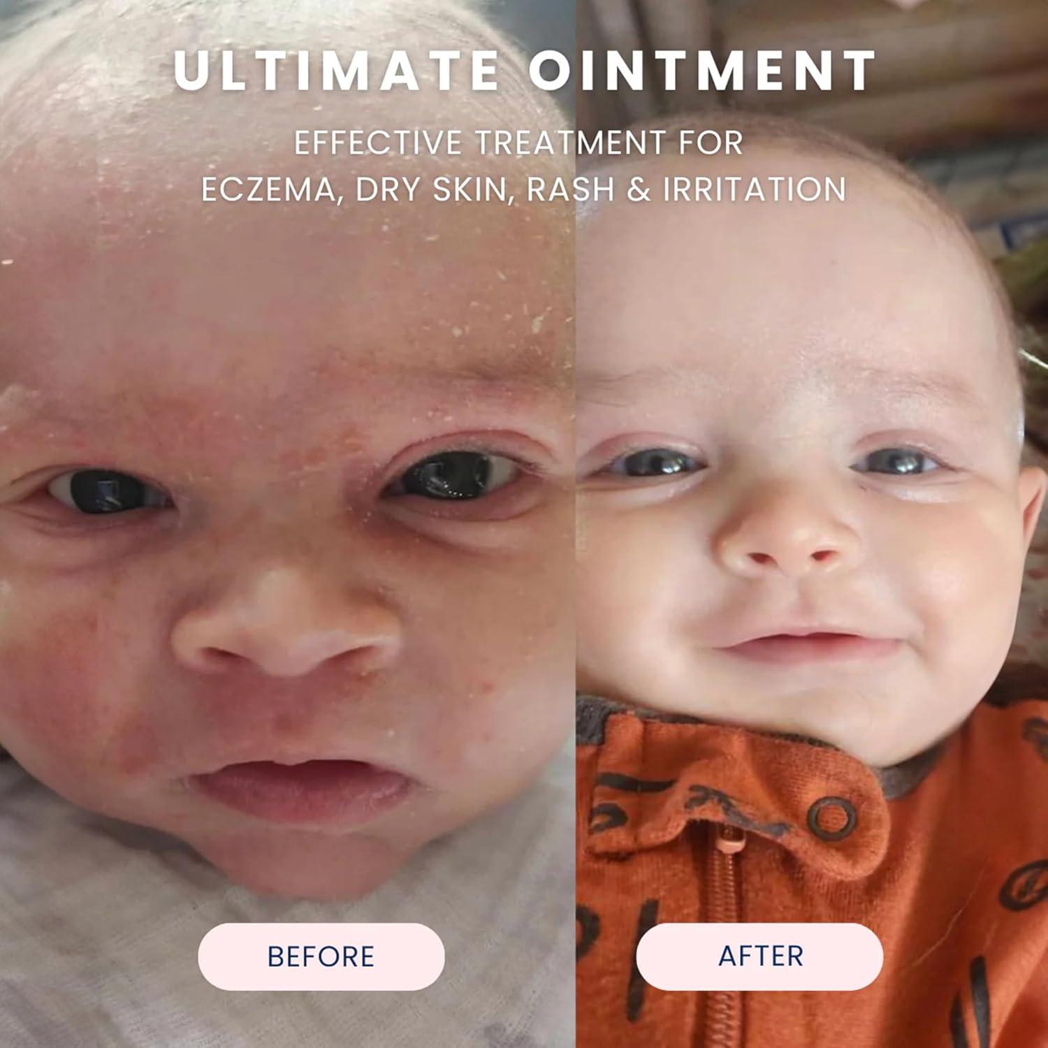 Ungüento Protector para Bebés Noodle & Boo 96g - Eccema y Piel Seca