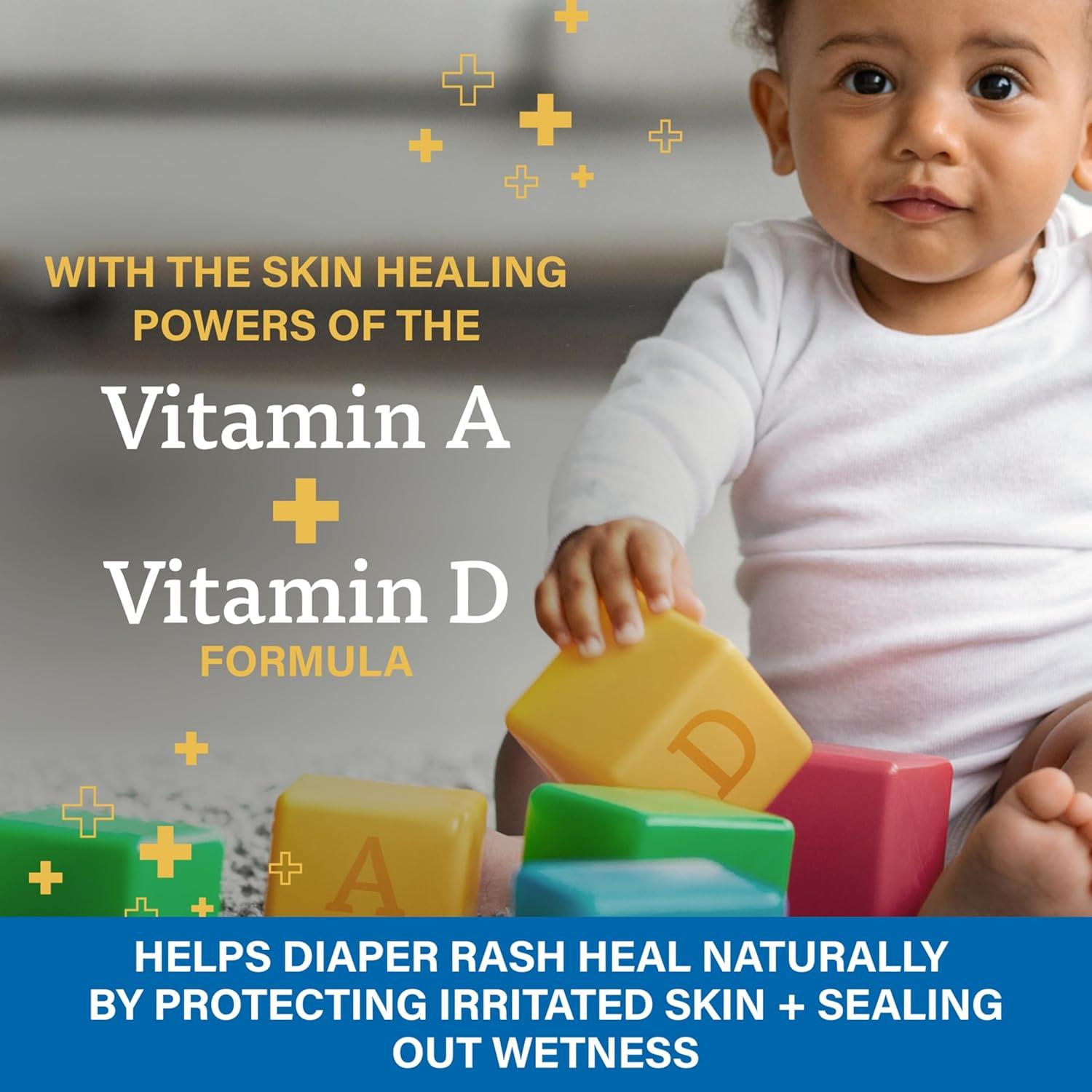 Crema A+D para Erupciones por Pañal 113.4g con Óxido de Zinc