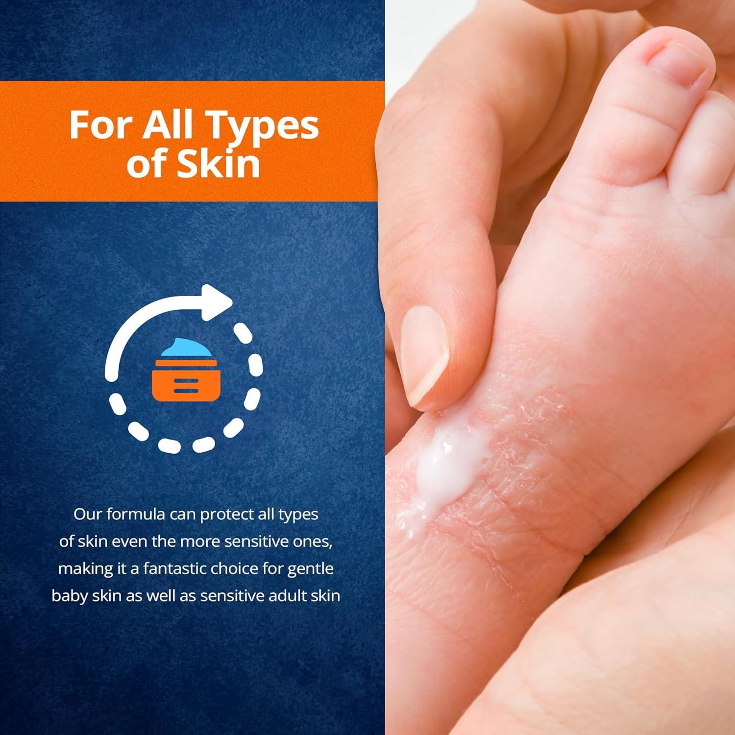 MedPride MPR-30456 Vitamins A and D Ointment, Diaper Rash Skin Protectant, 4 oz. Bottle