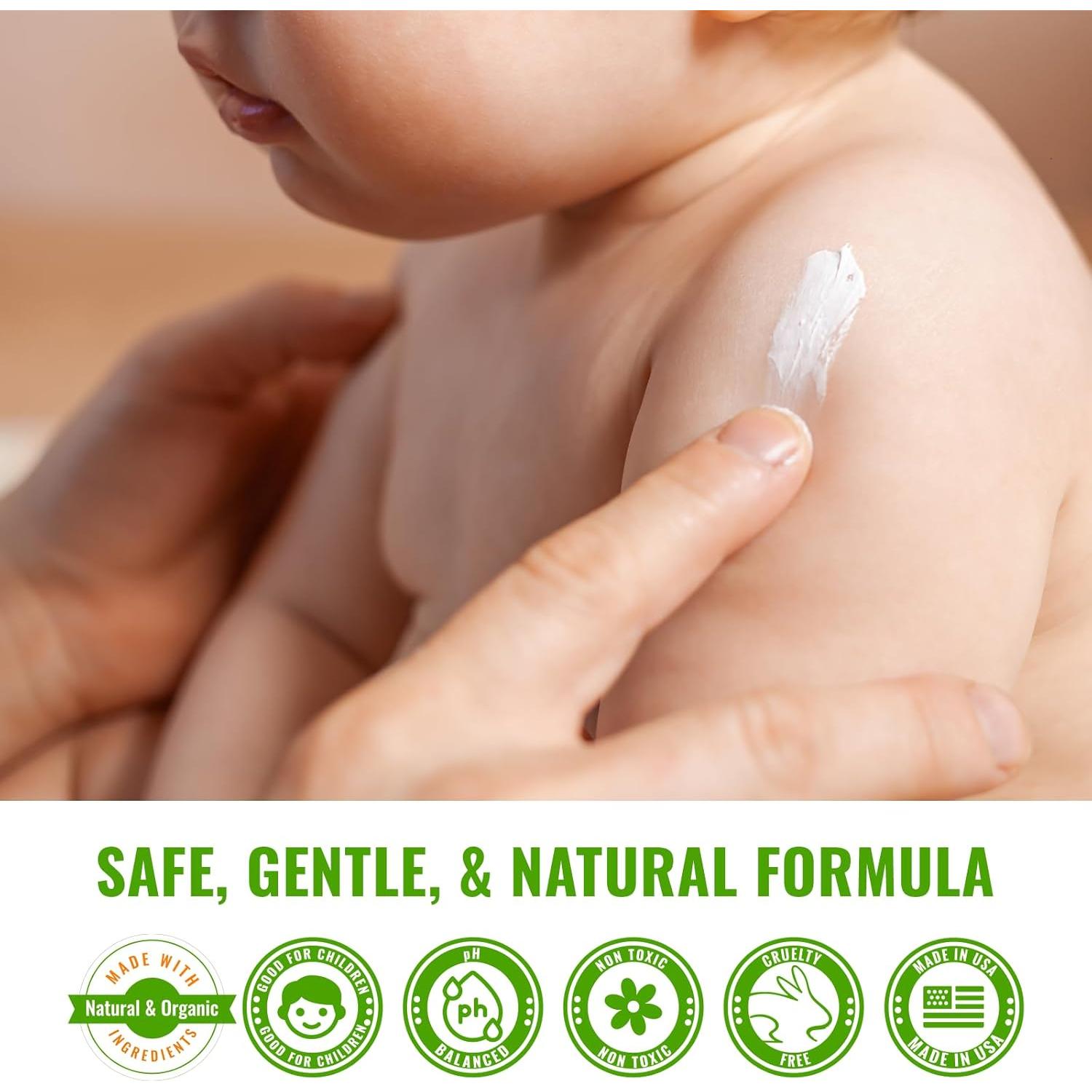 Crema para Eczema Bebé Wild Naturals 113g Hidratante Piel Sensible