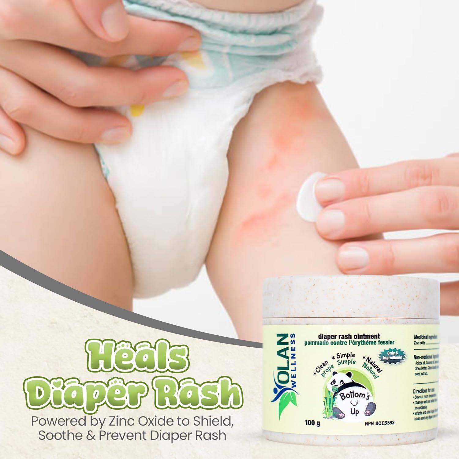 Crema para Erupciones de Pañal Olan Wellness 99.7g - Natural