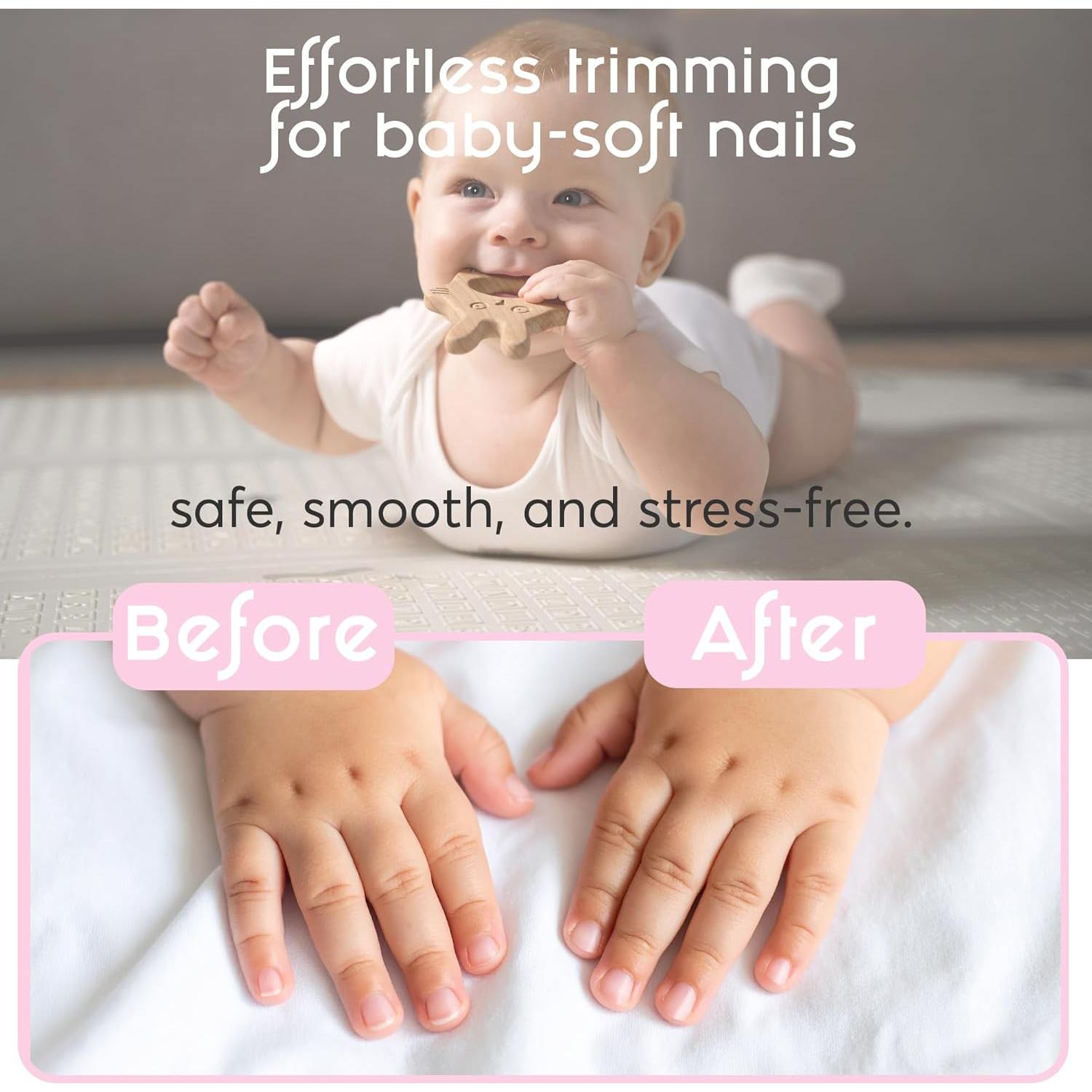 Cortador de Uñas Eléctrico Elan para Bebés y Niños - 6 Accesorios