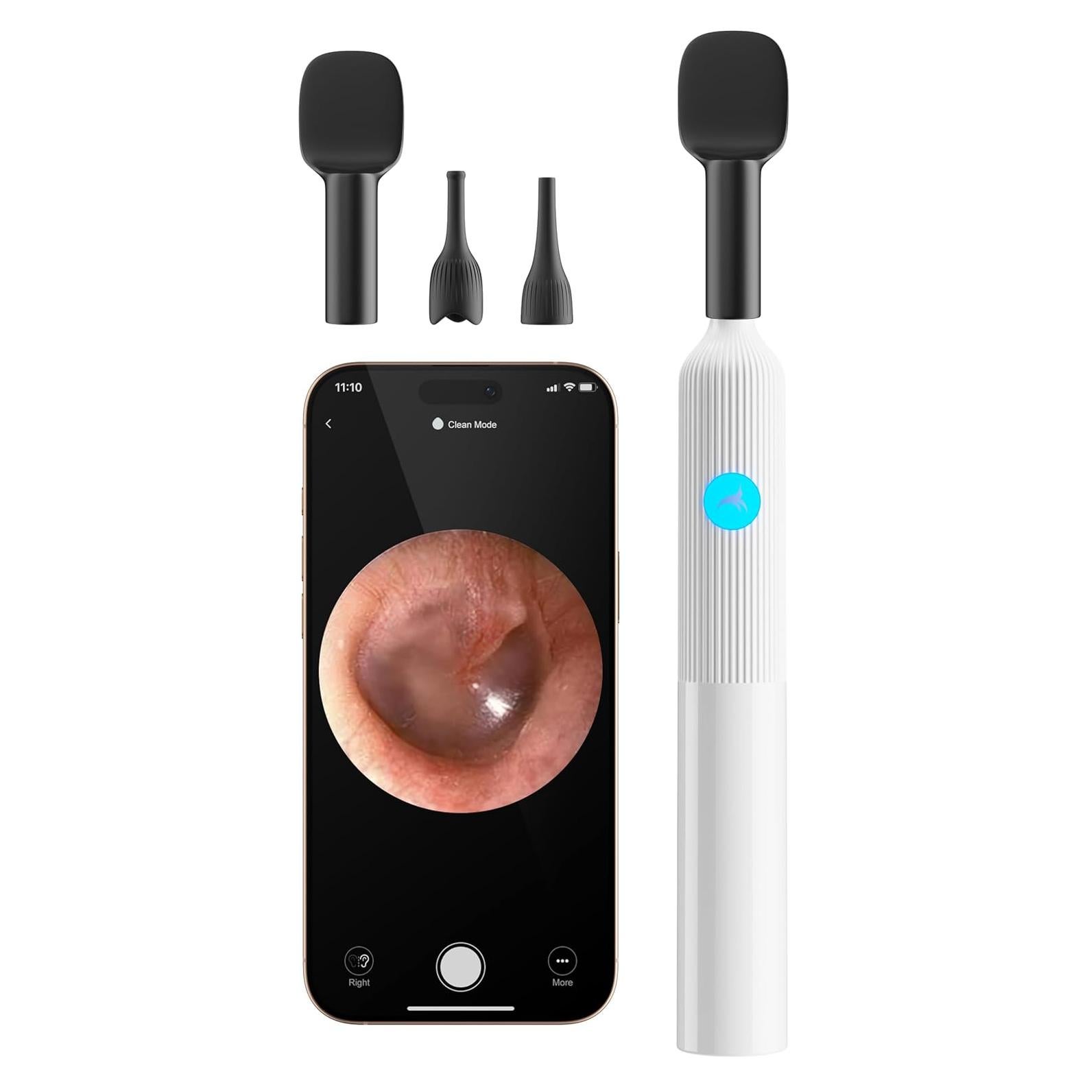 Kit de Examen ENT para Bebés OTTOLIVES con Cámara HD