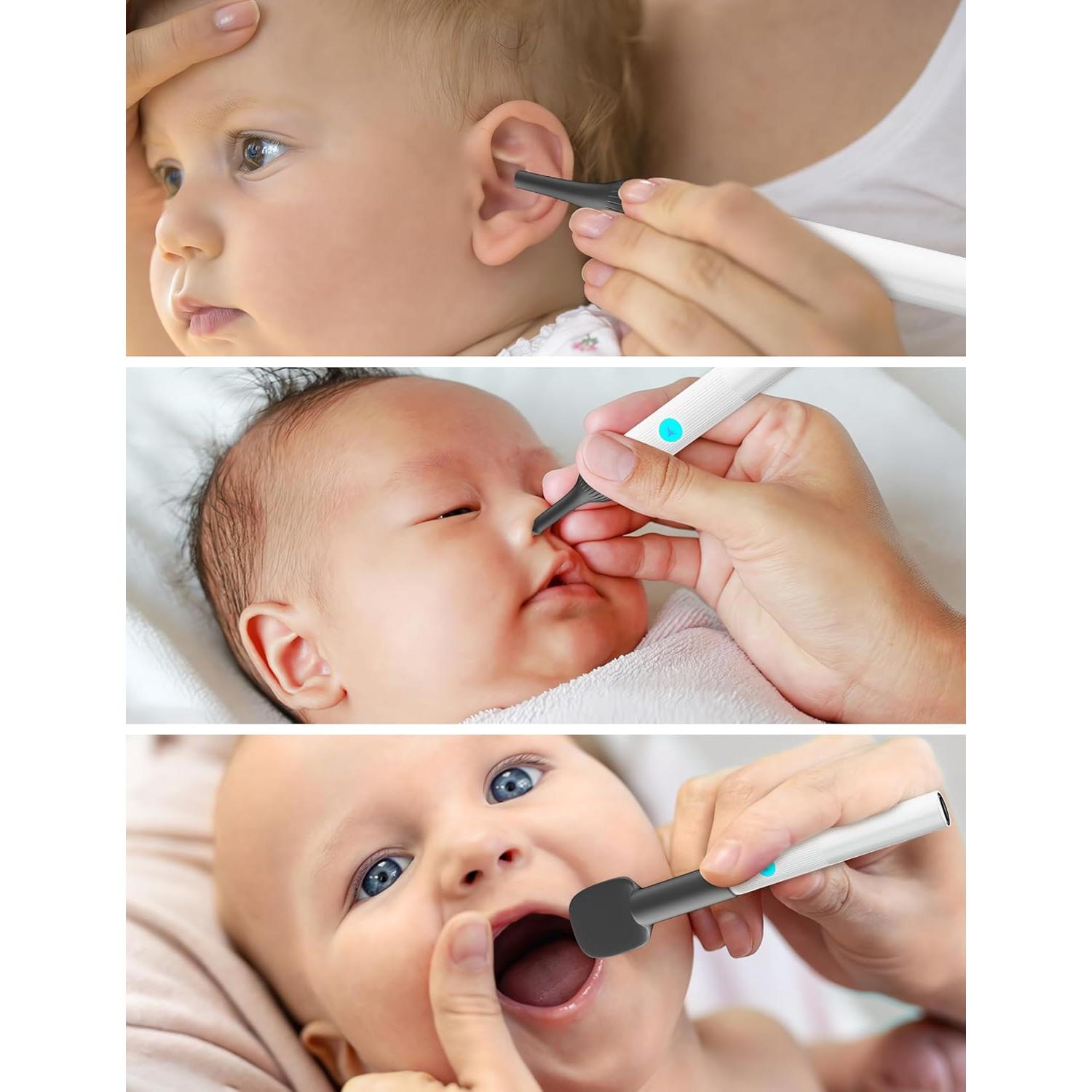 Kit de Examen ENT para Bebés OTTOLIVES con Cámara HD