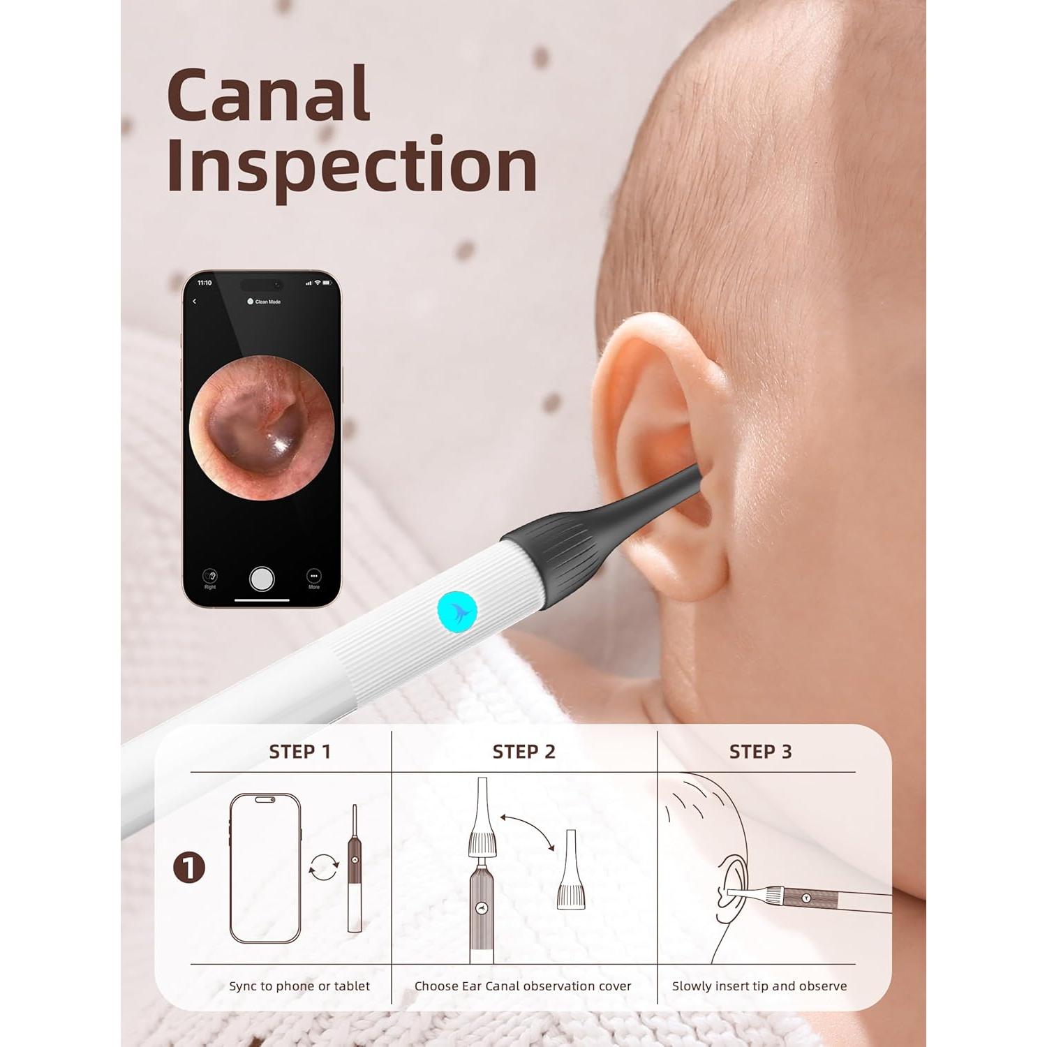 Kit de Examen ENT para Bebés OTTOLIVES con Cámara HD
