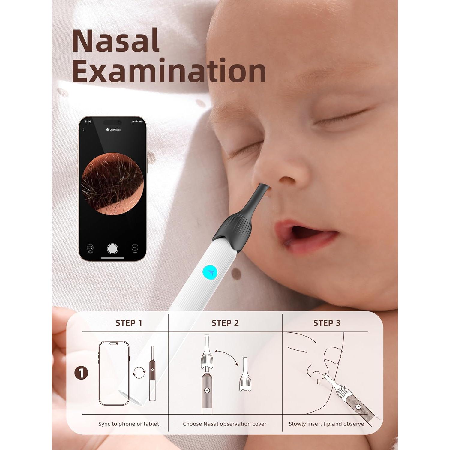 Kit de Examen ENT para Bebés OTTOLIVES con Cámara HD