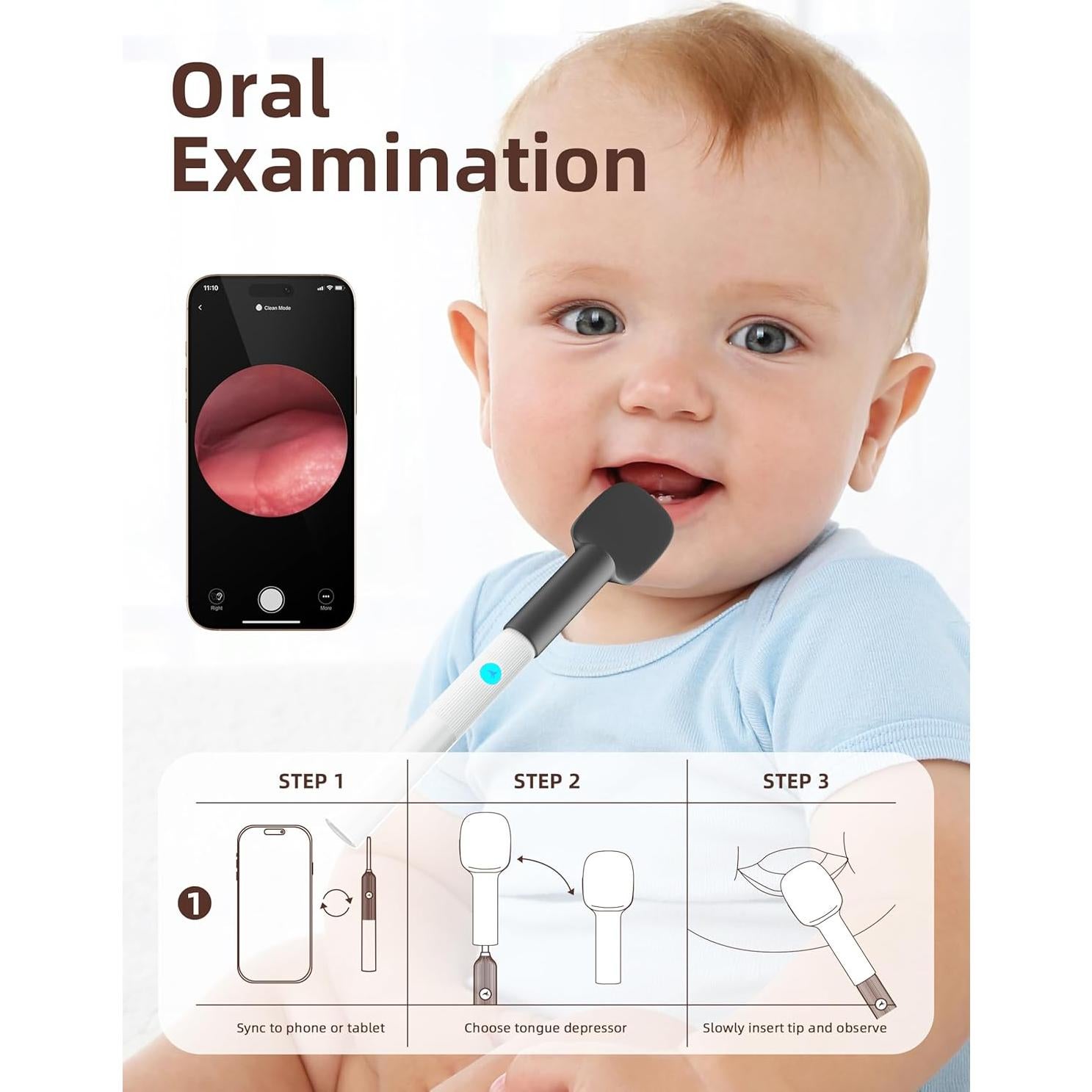 Kit de Examen ENT para Bebés OTTOLIVES con Cámara HD