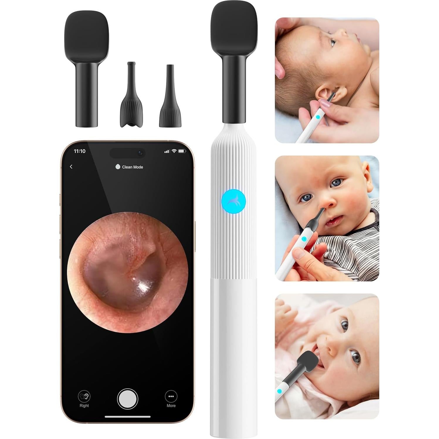 Kit de Examen ENT para Bebés OTTOLIVES con Cámara HD