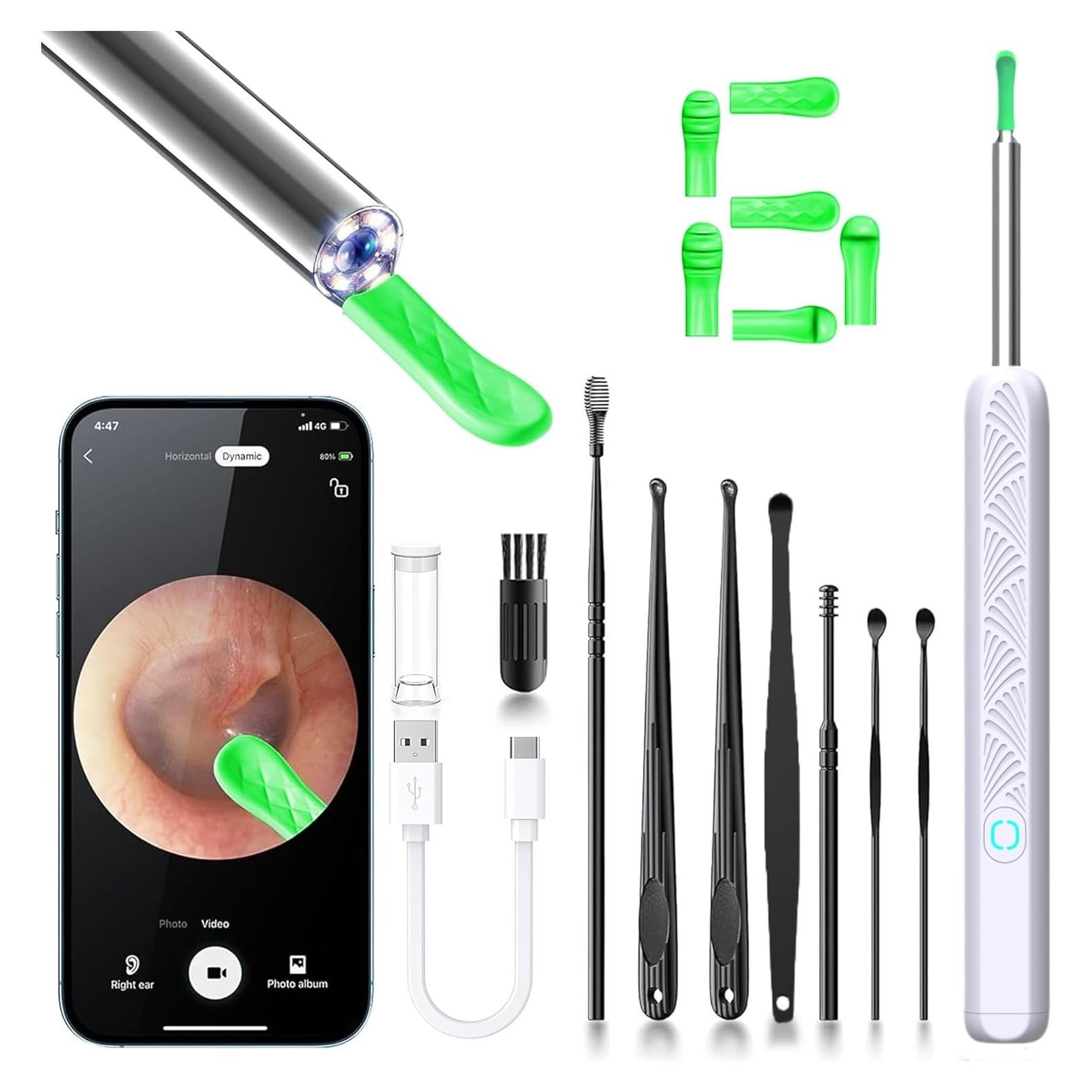 Kit de Eliminación de Cerumen CZYJPRL con Cámara 1080P