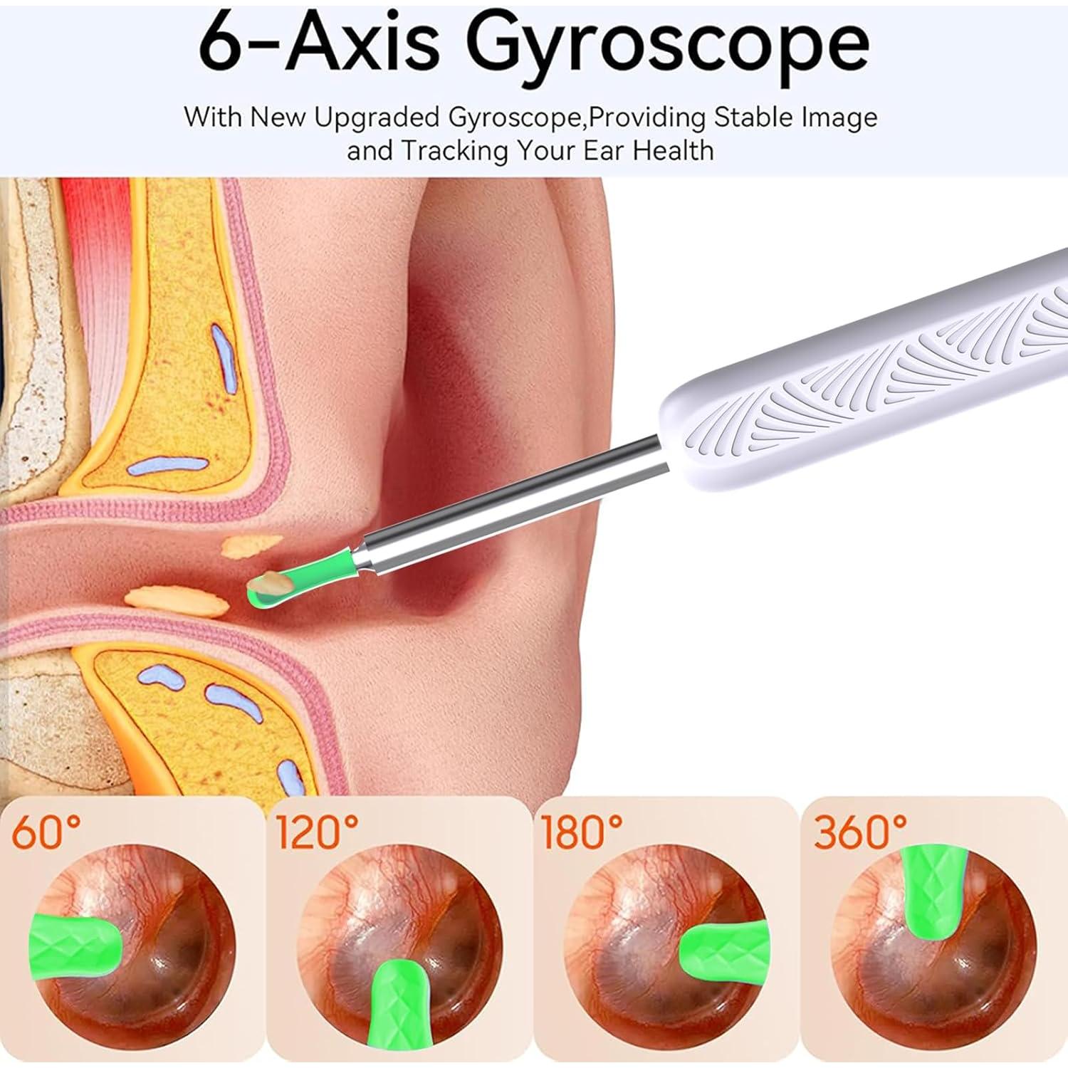 Kit de Eliminación de Cerumen CZYJPRL con Cámara 1080P