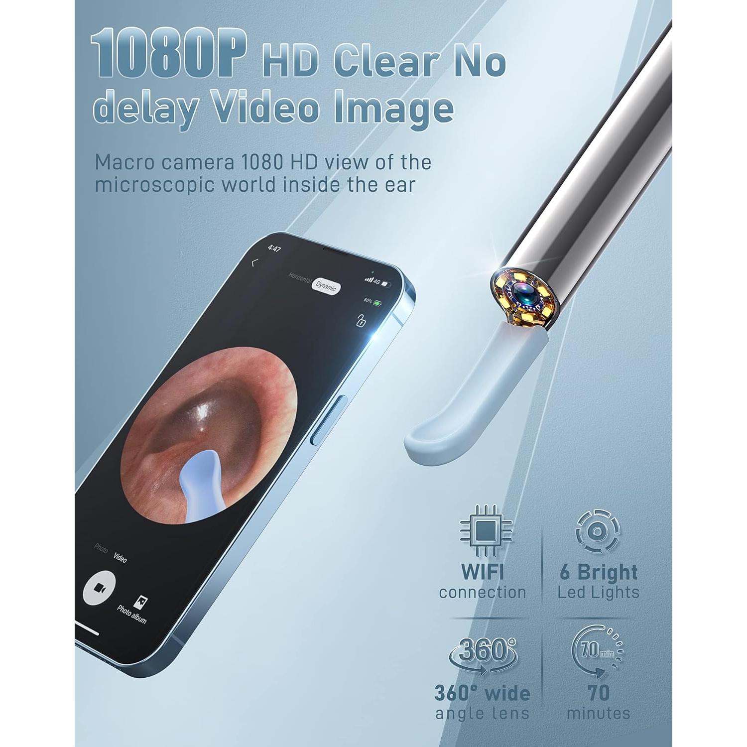 Limpiador de Oído Kolrry con Cámara 1080P y 6 Cucharas