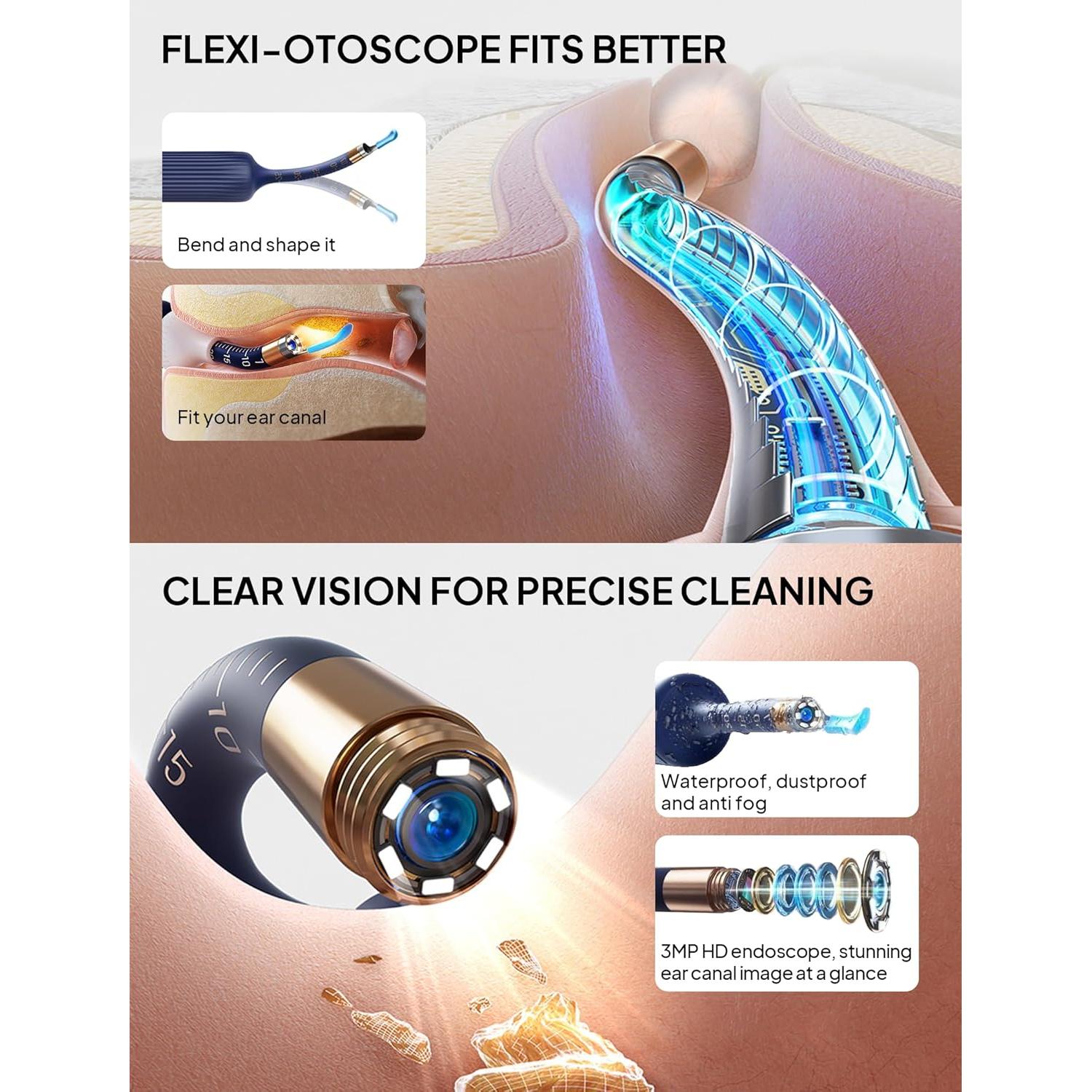 Kit de Limpieza de Oídos Yumika con Cámara HD y Pinzas