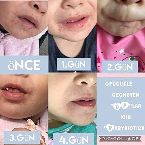 Spray Probiotico Tópico BabyBiotics 113g - Hipoalergénico, Vegano