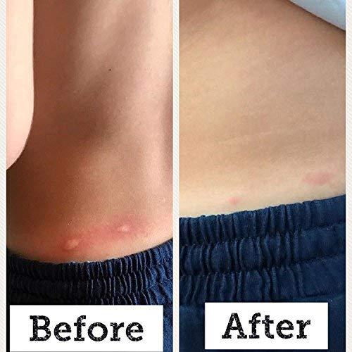 Spray Probiotico Tópico BabyBiotics 113g - Hipoalergénico, Vegano