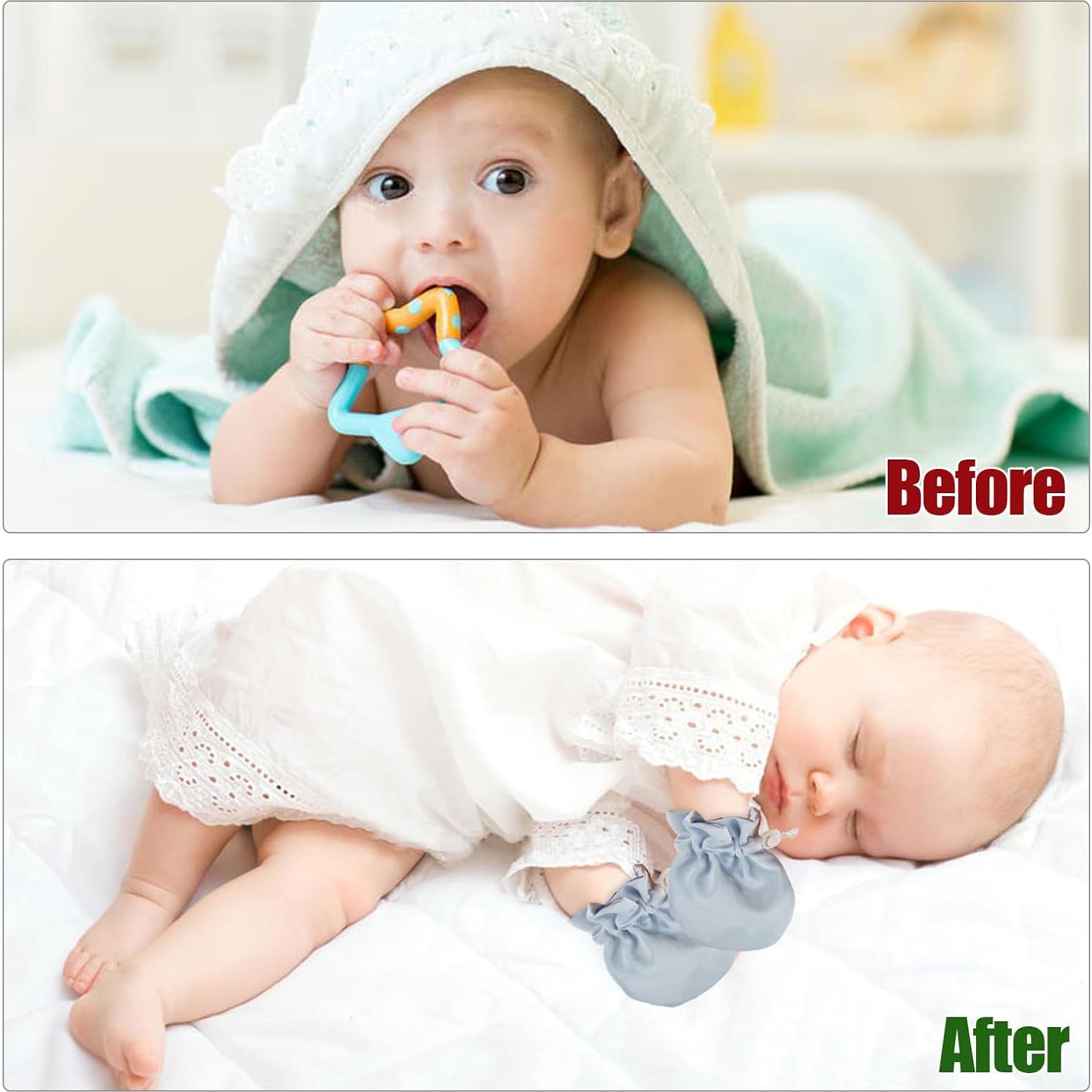 Mitones de Eczema para Bebés GZYTMYGS - Alivio Piel Sensible