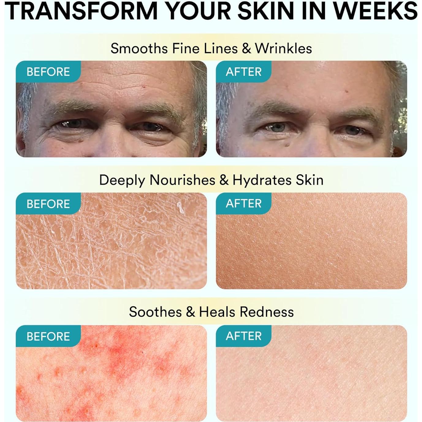 Bálsamo Hidratante Facial Cupido con Manteca de Res y Miel 159g