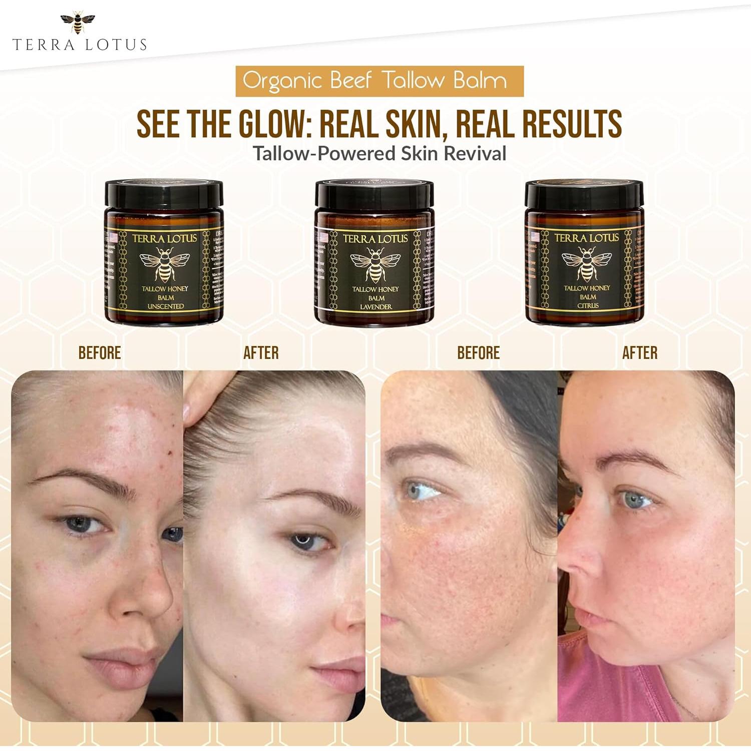 Bálsamo Hidratante Terra Lotus 113g Sebo de Res Orgánico Cítricos