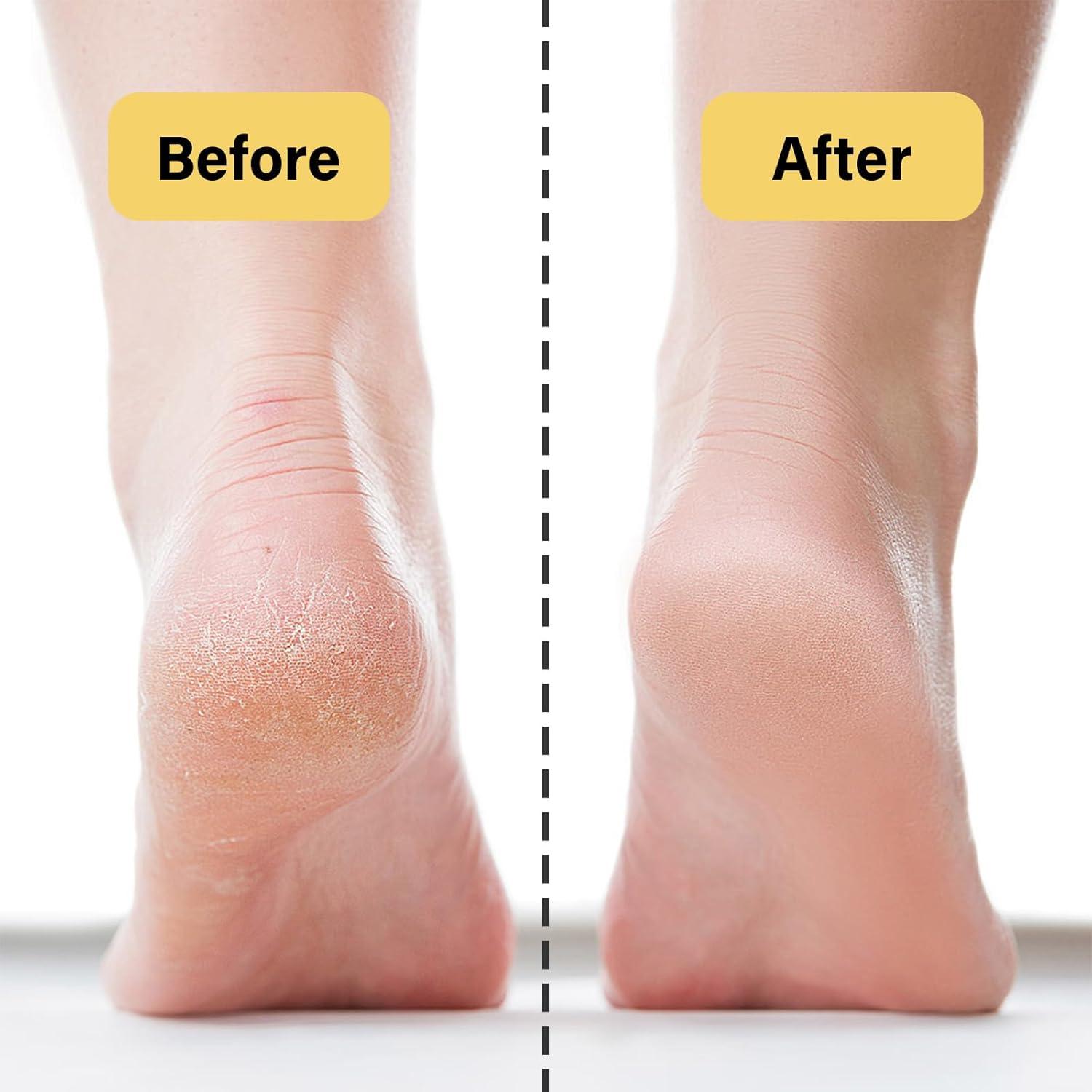 Bálsamo Hidratante Facial Acosexy 143.4 g - Sebo de Res Orgánico