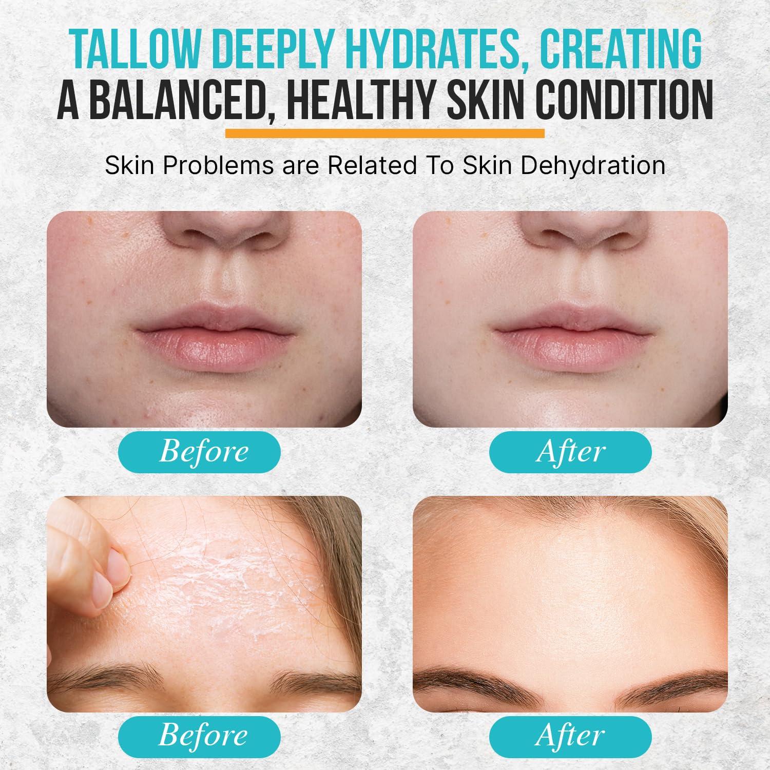 Bálsamo Hidratante Familiar Herd & Honey 159g - Sebo y Miel