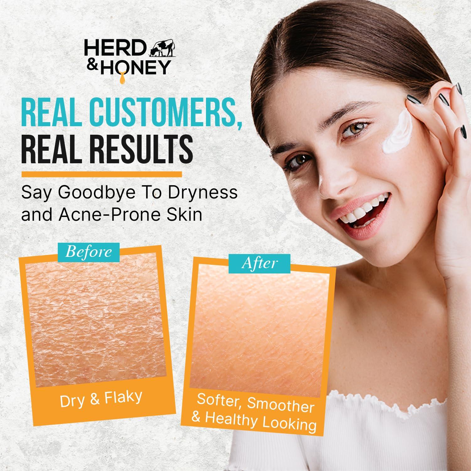 Bálsamo Hidratante Familiar Herd & Honey 159g - Sebo y Miel