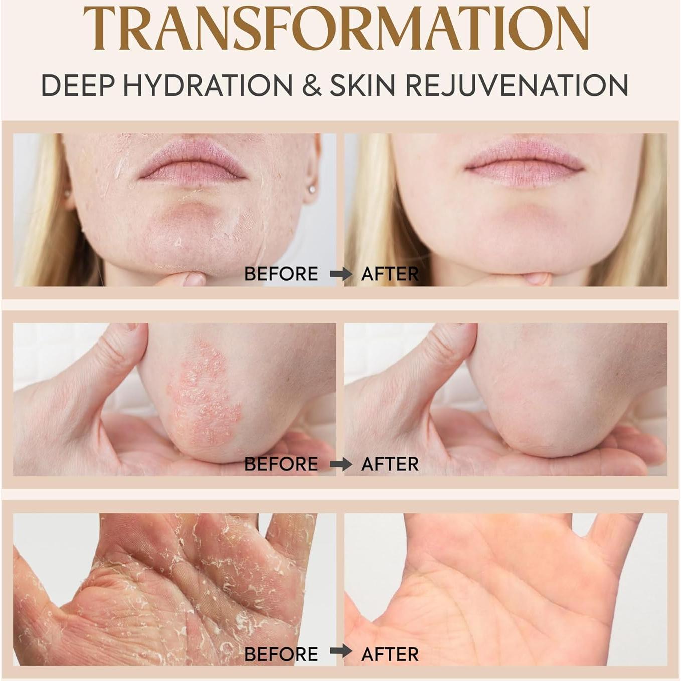 Bálsamo de Tallow Dersie 100% Orgánico para Piel Seca 198g