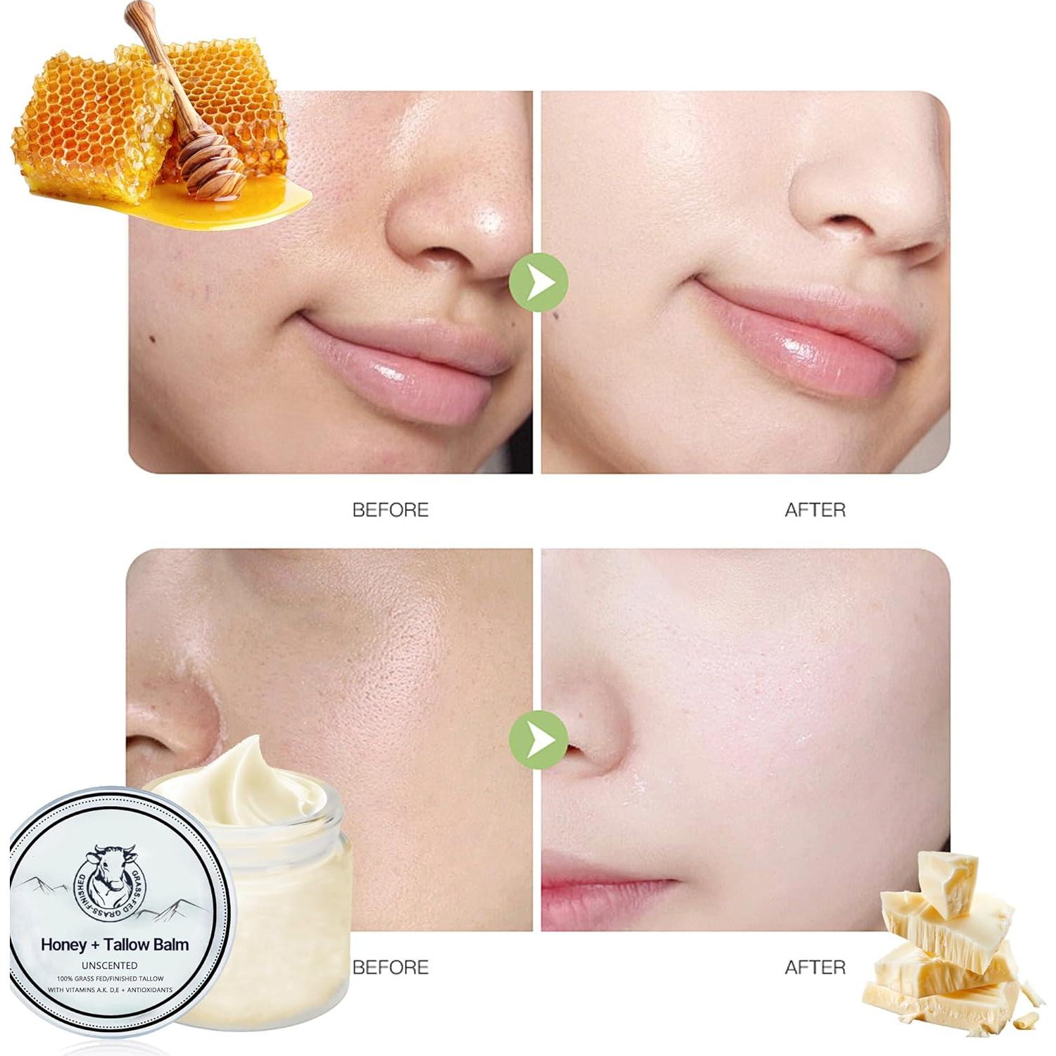 Bálsamo Hidratante Orgánico NEWUREHO con Miel y Sebo de Res 167g