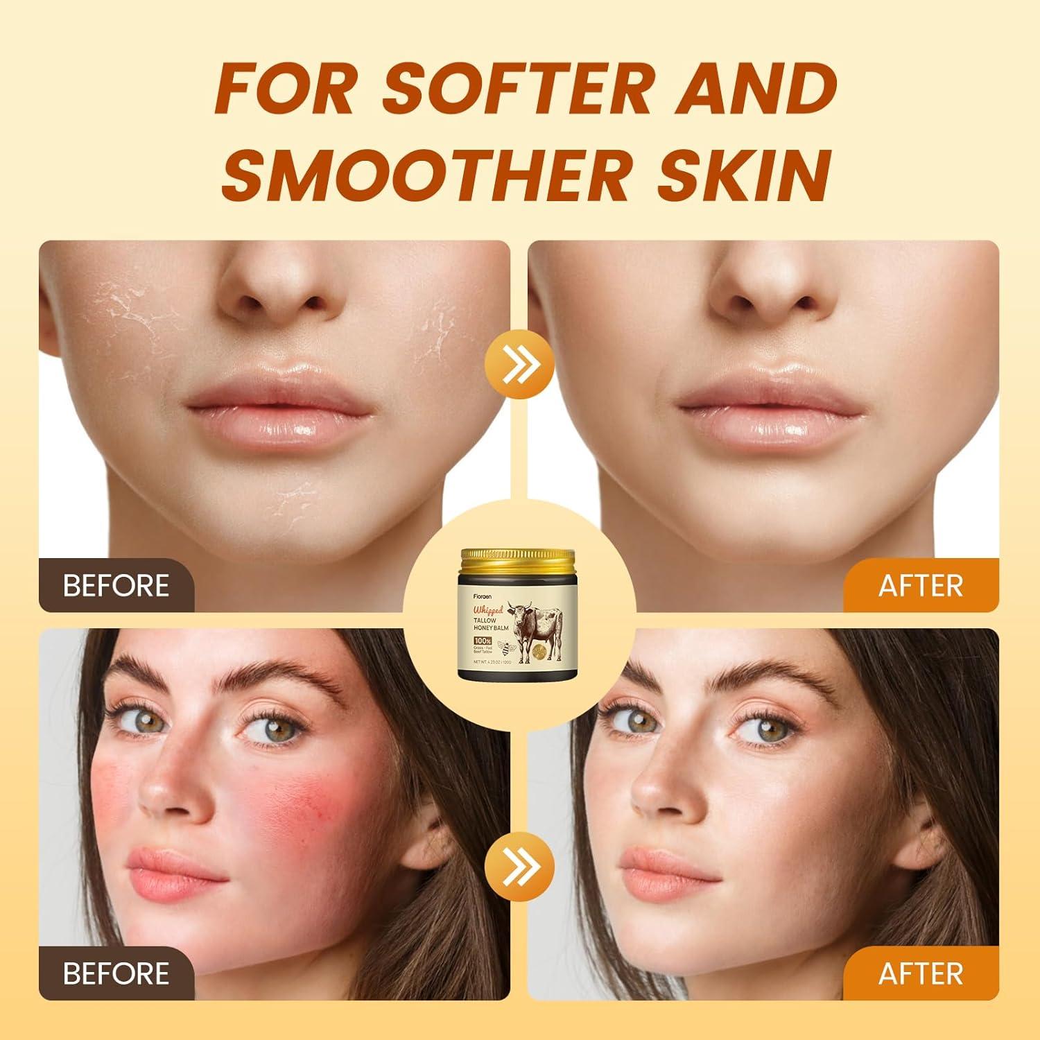 Bálsamo Hidratante Fioraen de Manteca de Res y Miel 118 ml