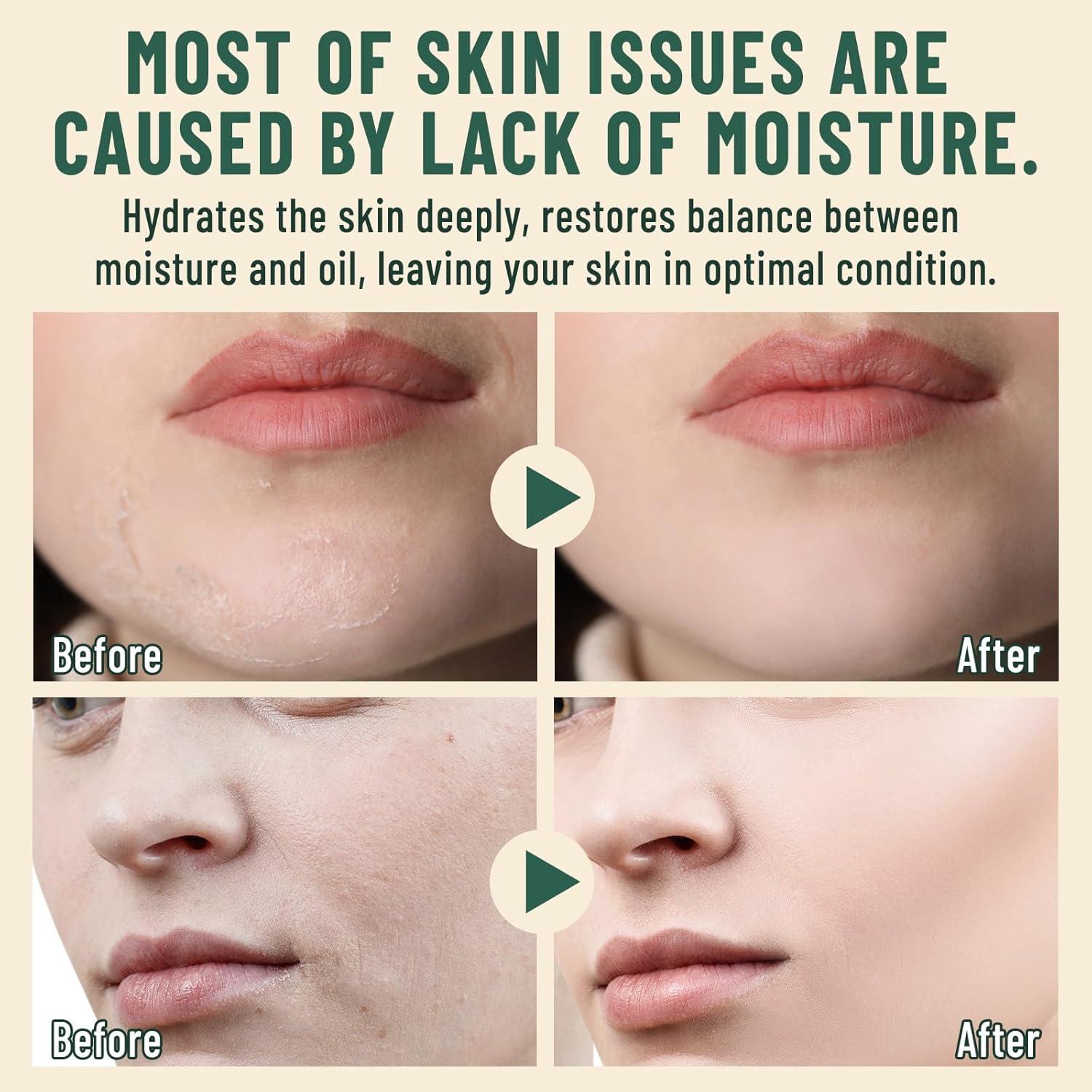 Bálsamo Hidratante Facial MOOMARTO con Grasa de Res 82g