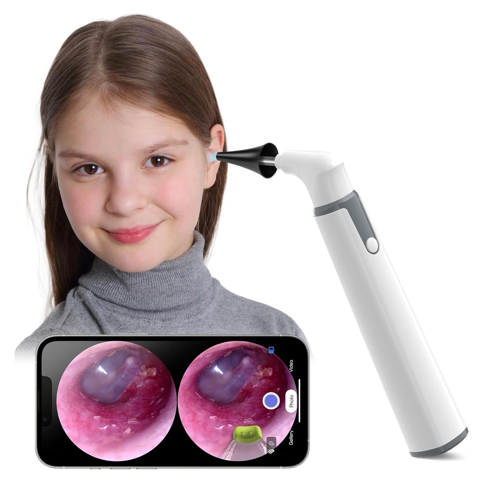 Otoscopio WiFi 720p HD ScopeAround con Luz LED 3.9mm