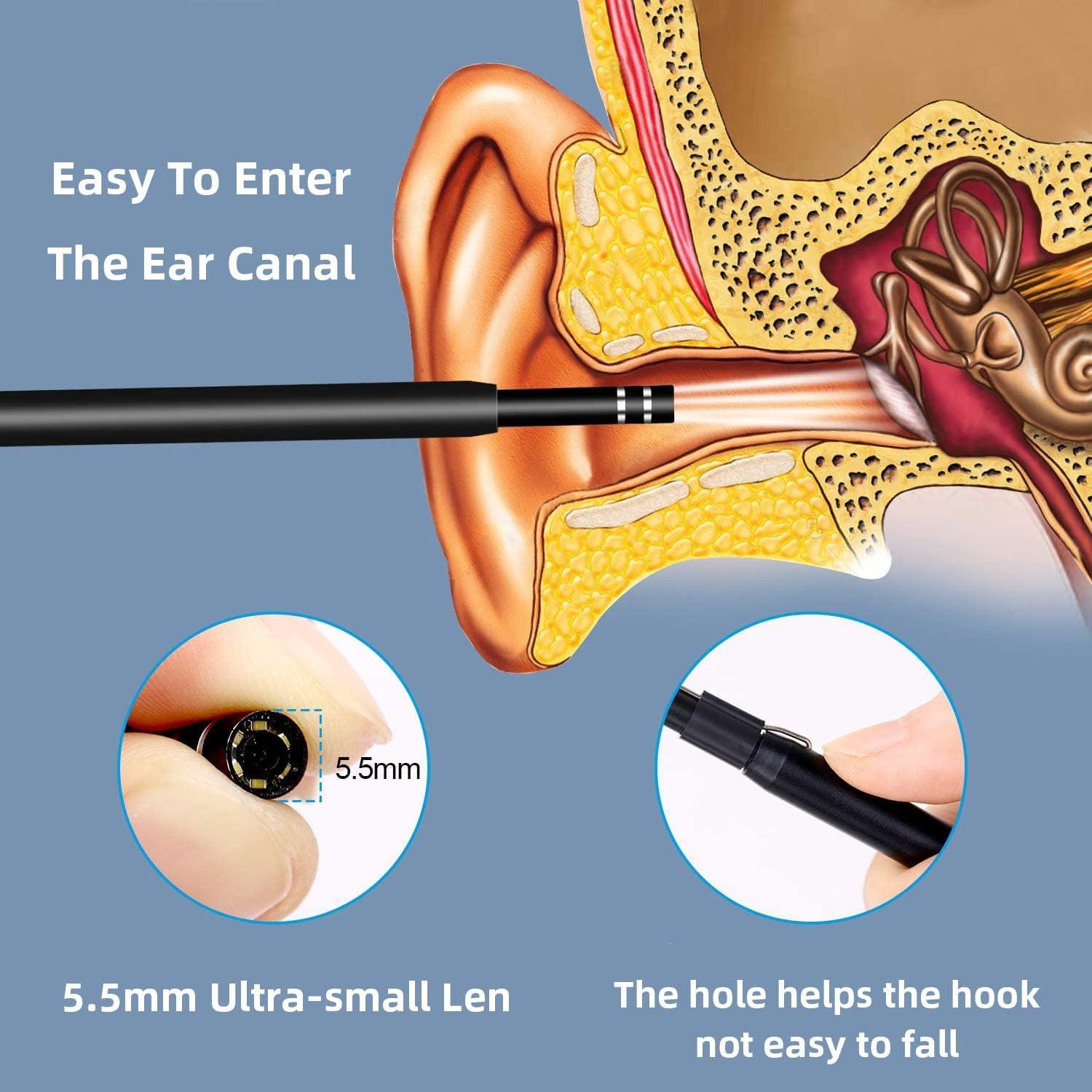 Kit de Limpieza de Oídos Pthene con Cámara HD y Luz LED 6 en 1