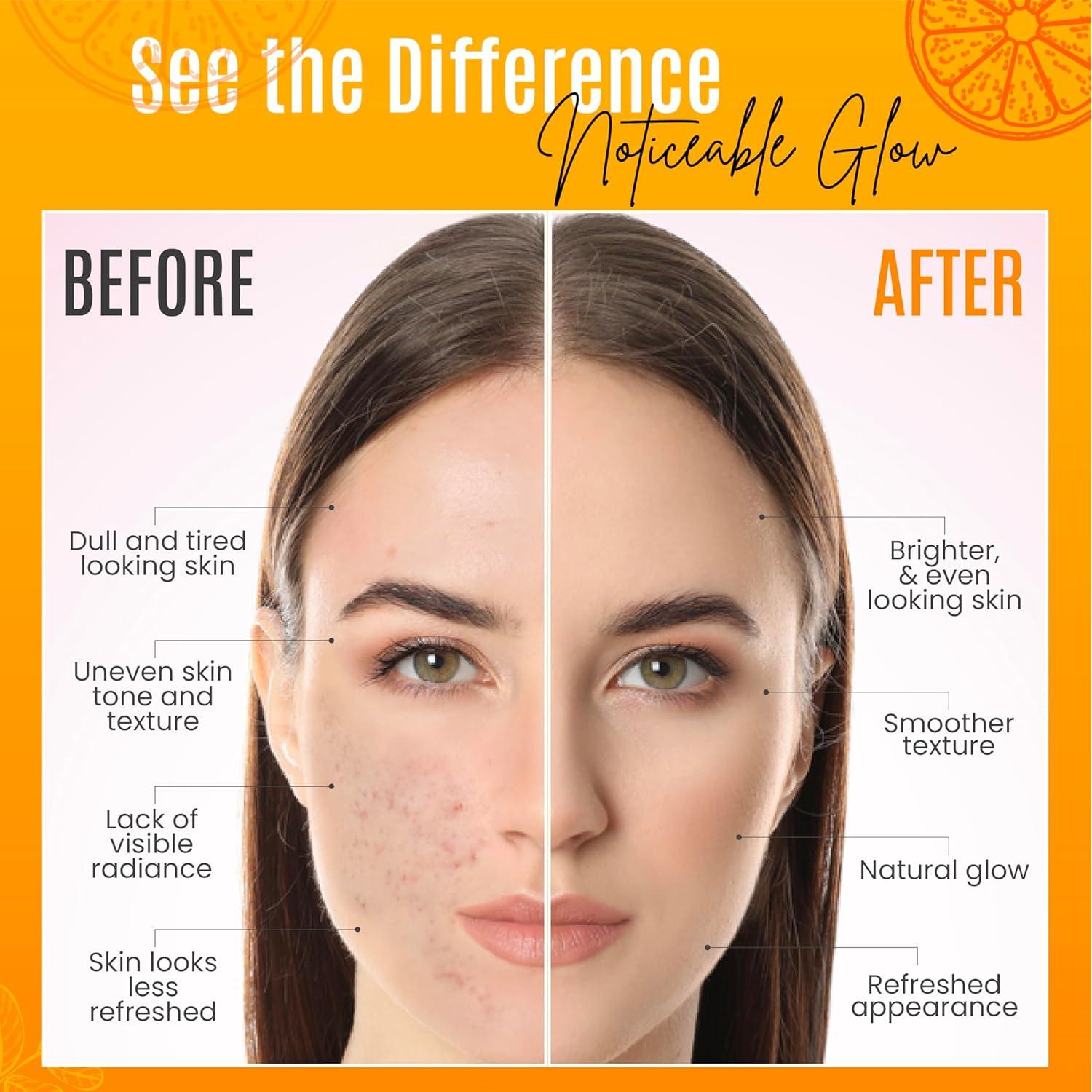 Suero de Vitamina C 30% Naturals+SkinScience 29.57 ml