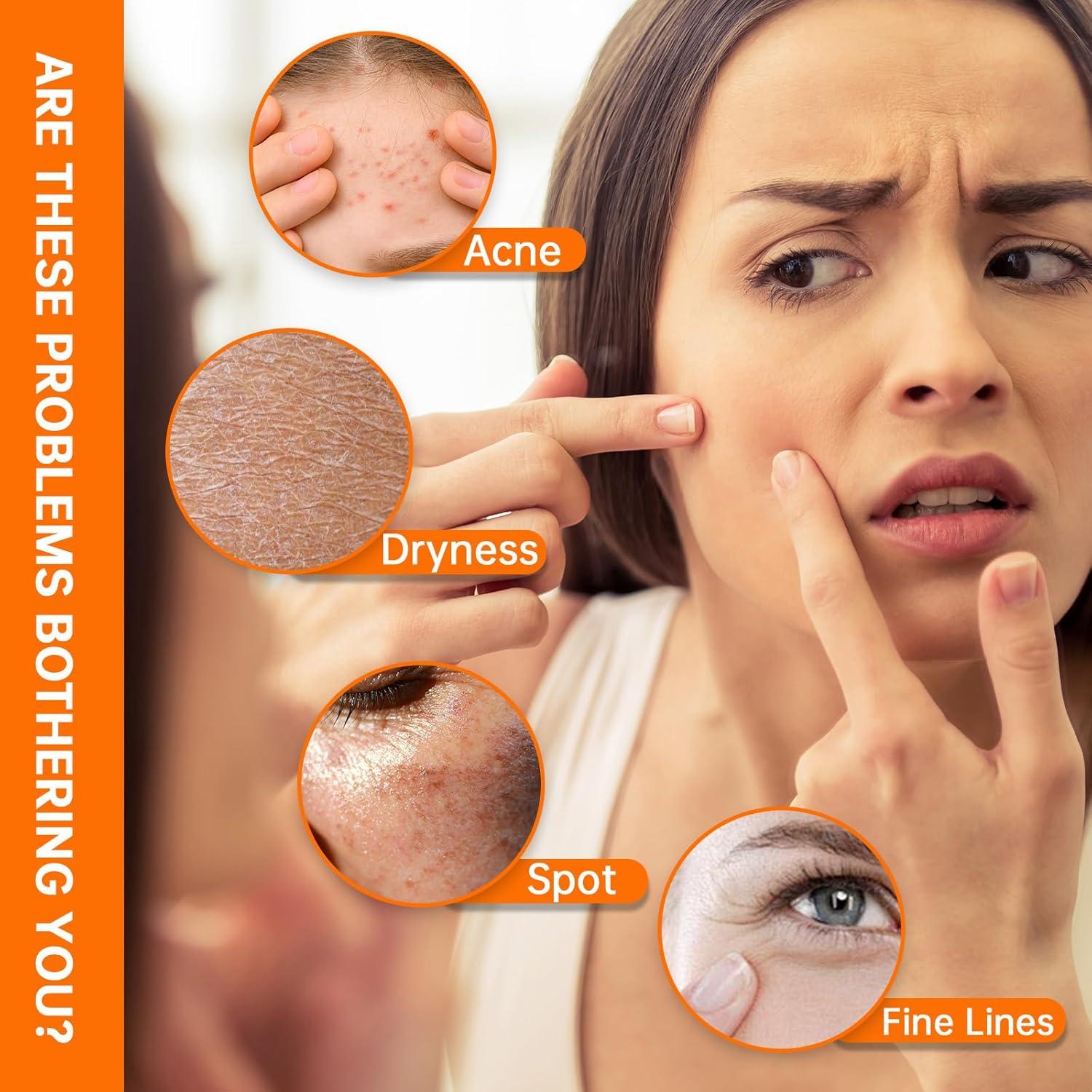 Suero Hidratante Facial Niacinamida 10% + Zinc 1% 81g