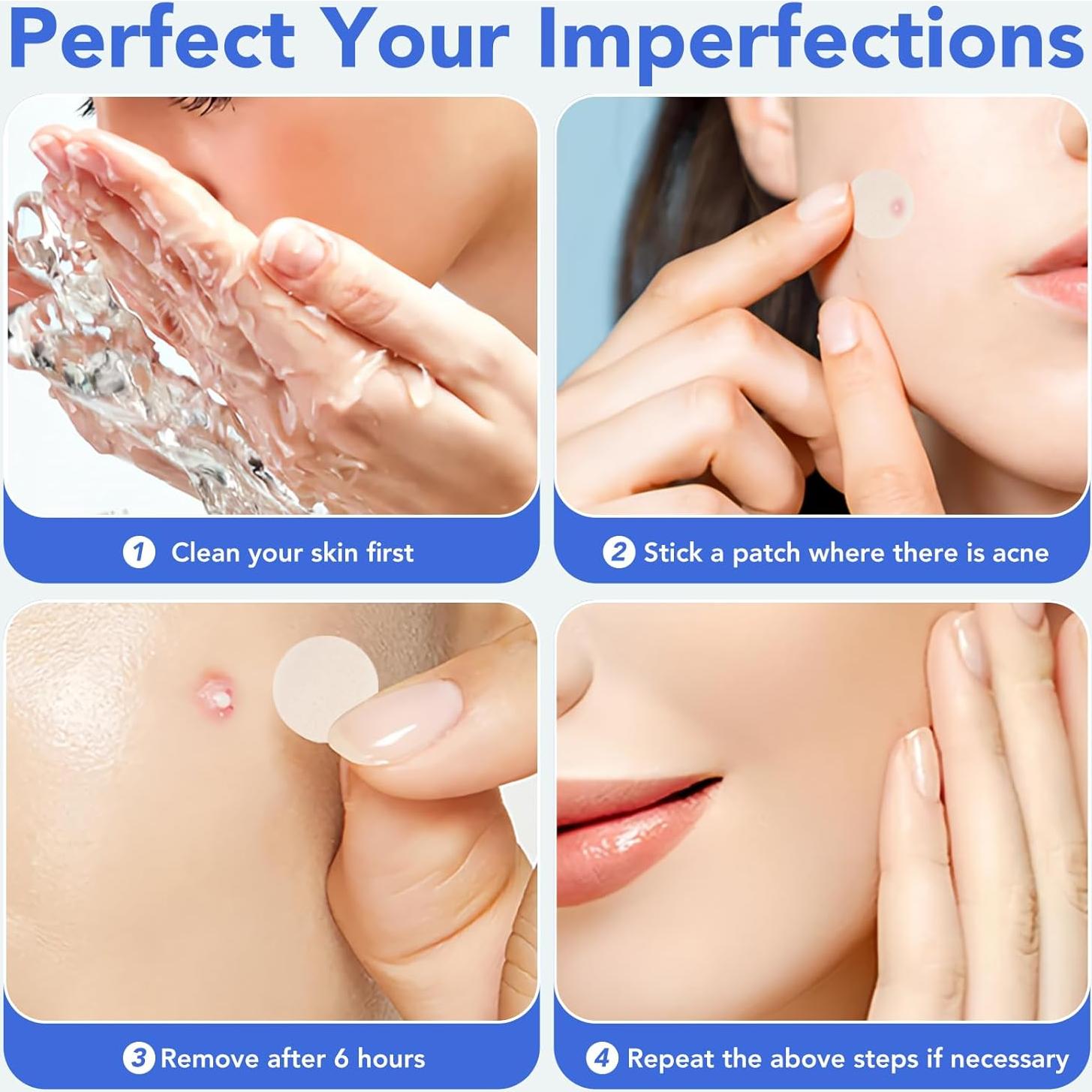 Parches Hidrocoloides para Granos Qmakup - 360 Unidades