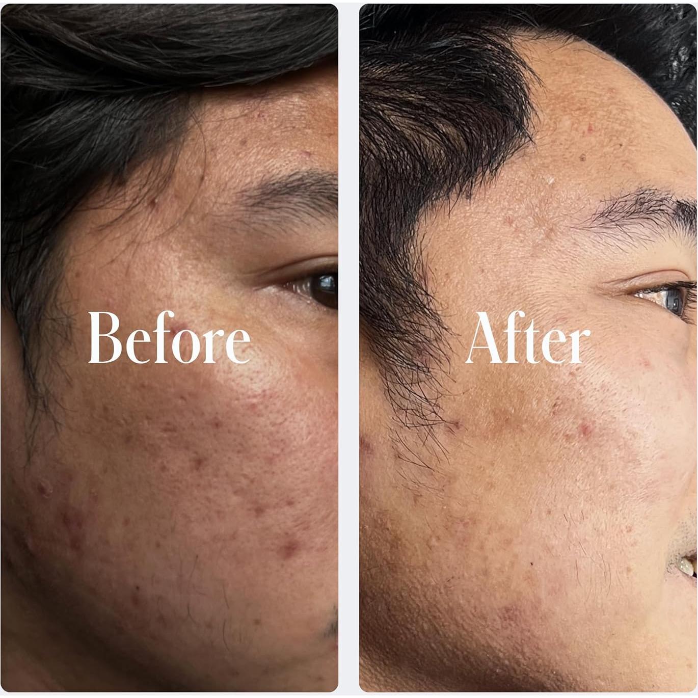 Crema Facial Anti-Envejecimiento Geologie 0.2% Retinol 117g