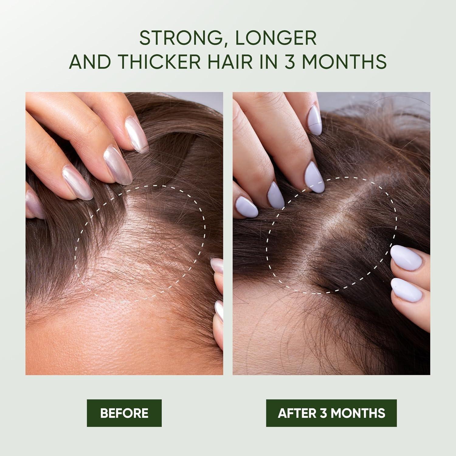 Rosemary Hair Growth Shampoo - Thickening Shampoo with Biotin Tea Tree Oil Mint for Hair Loss and Thinning Hair - for Women and Men 11.8 Fl Oz (Pack of 1)