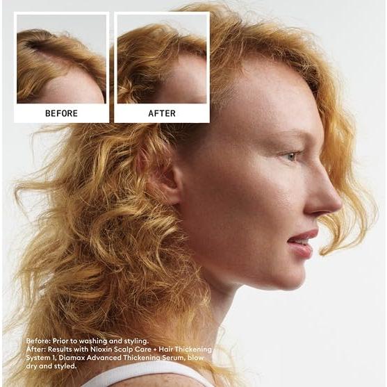 Kit de Engrosamiento de Cabello Nioxin Sistema 1 - 1 Mes