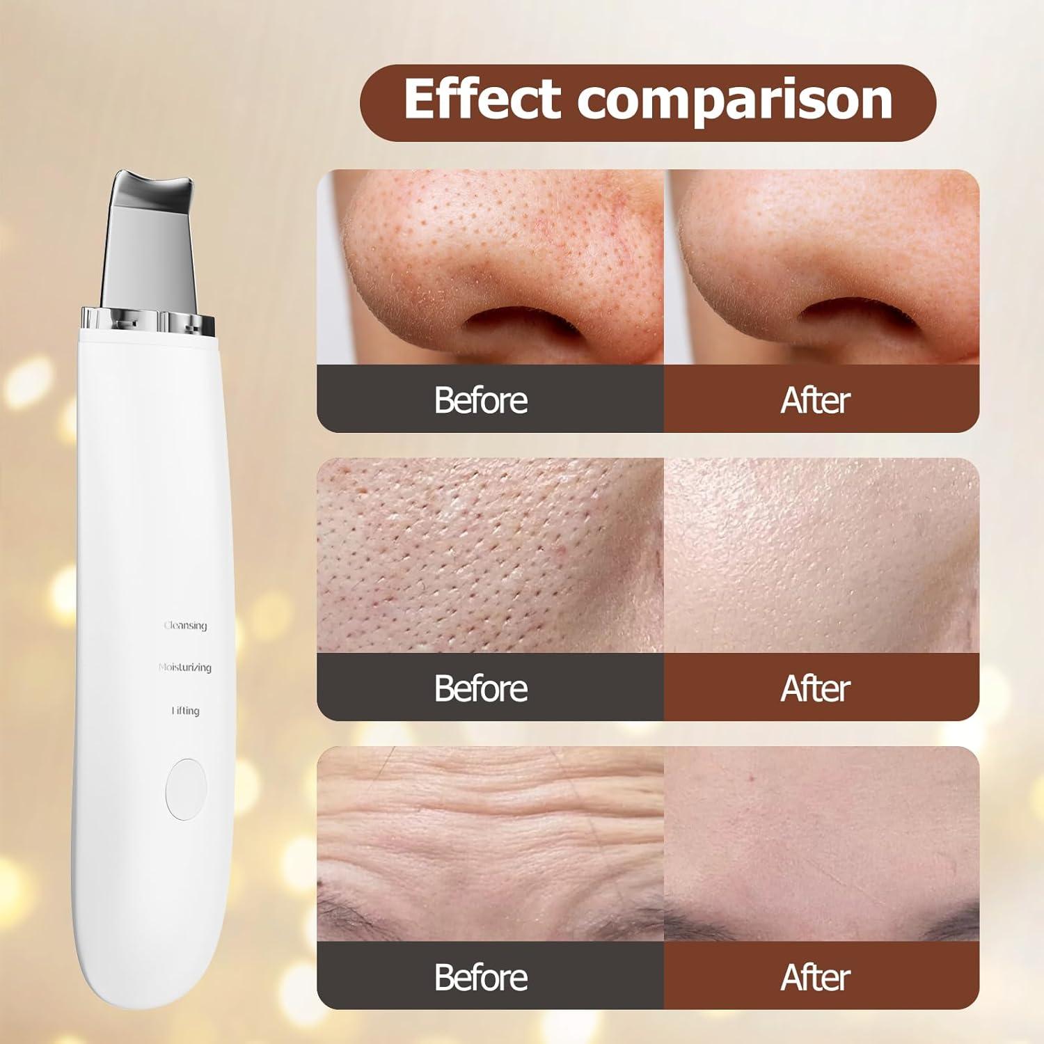 Espátula Facial Limpiadora Sawjay - 3 Modos para Piel Radiante