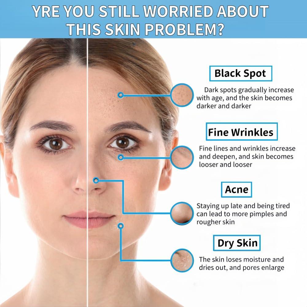 Suero Facial Niacinamida 10% + Zinc 1% 30ml - Control de Aceite y Acné