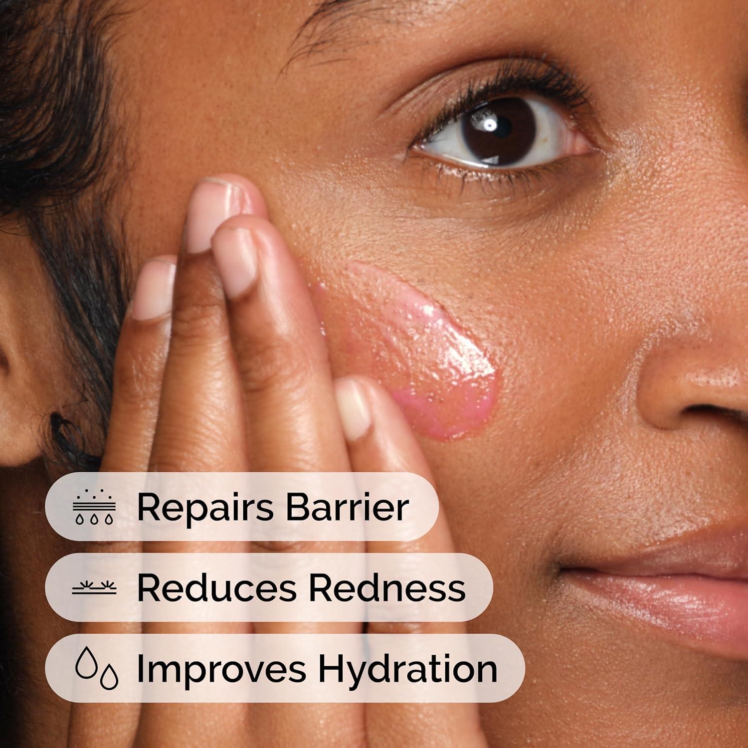 Suero Calmante The Ordinary 29.57 ml - Hidratante y Reductor de Enrojecimiento