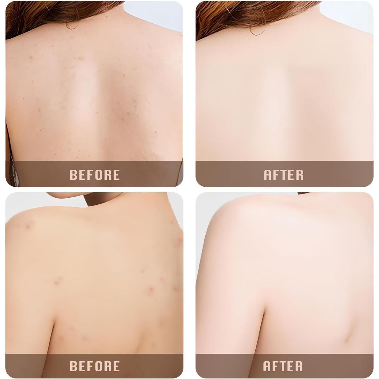 Esponja Exfoliante de Red Africana YATCHA 120 cm Verde Profundo