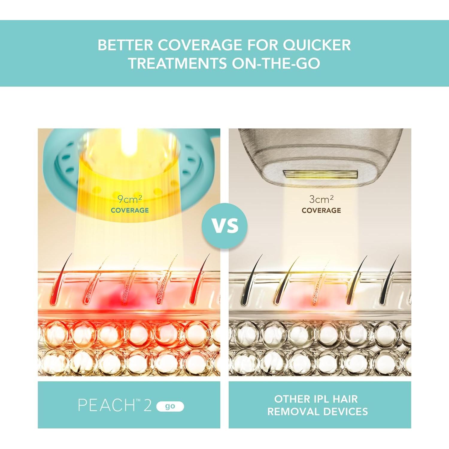 Dispositivo IPL FOREO PEACH 2 go - Eliminación de Vello Indolora